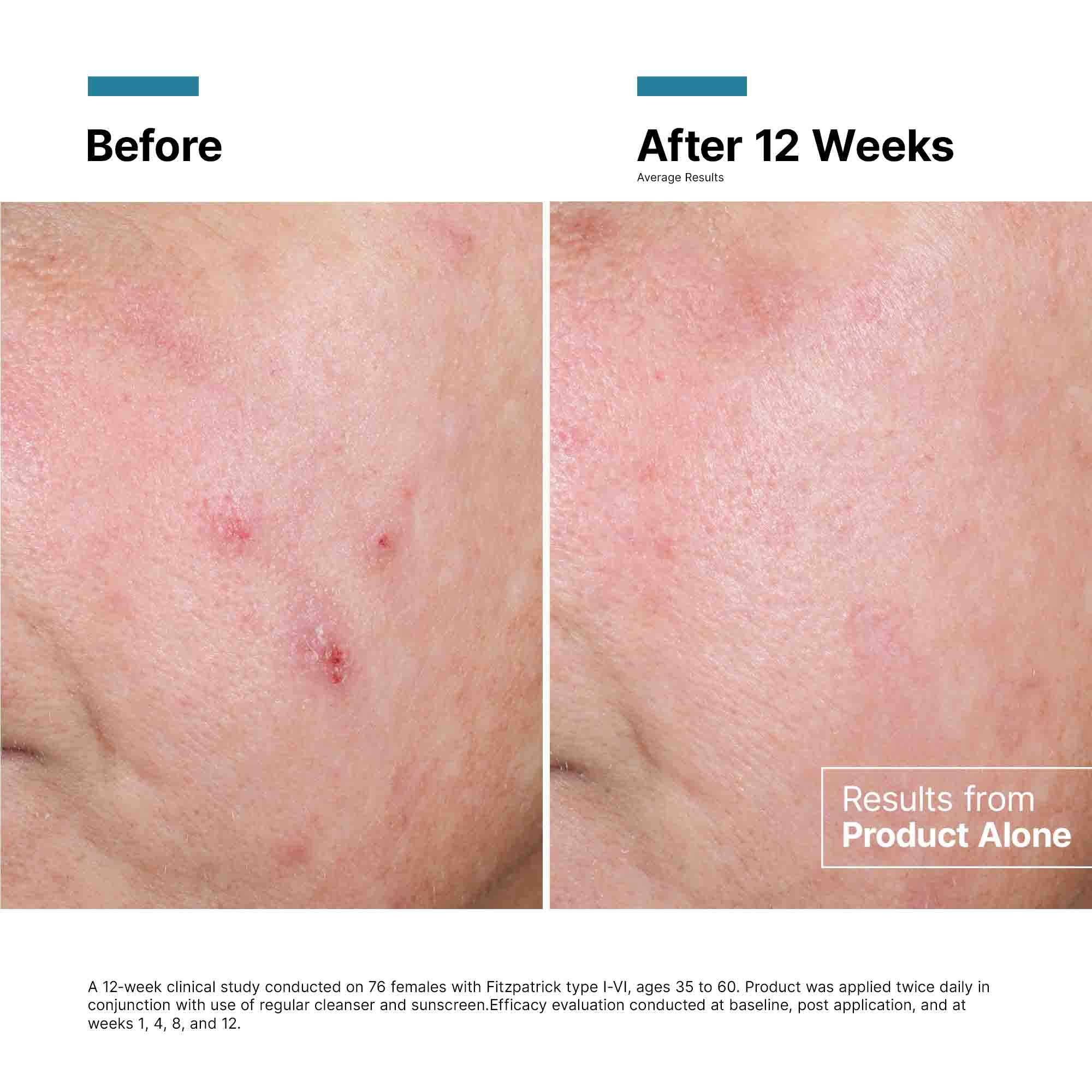 Advanced RGN 6 Regenerative Cream for Face & Body - Anti-Aging Moisturizer with Collagen Boost - Perfect for Night Repair & Daily Hydration