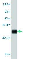Anti-ACACA Mouse Monoclonal Antibody [Clone 6H5] - 100µG for Western Blot, Immunoprecipitation & ELISA - Lab Research Use