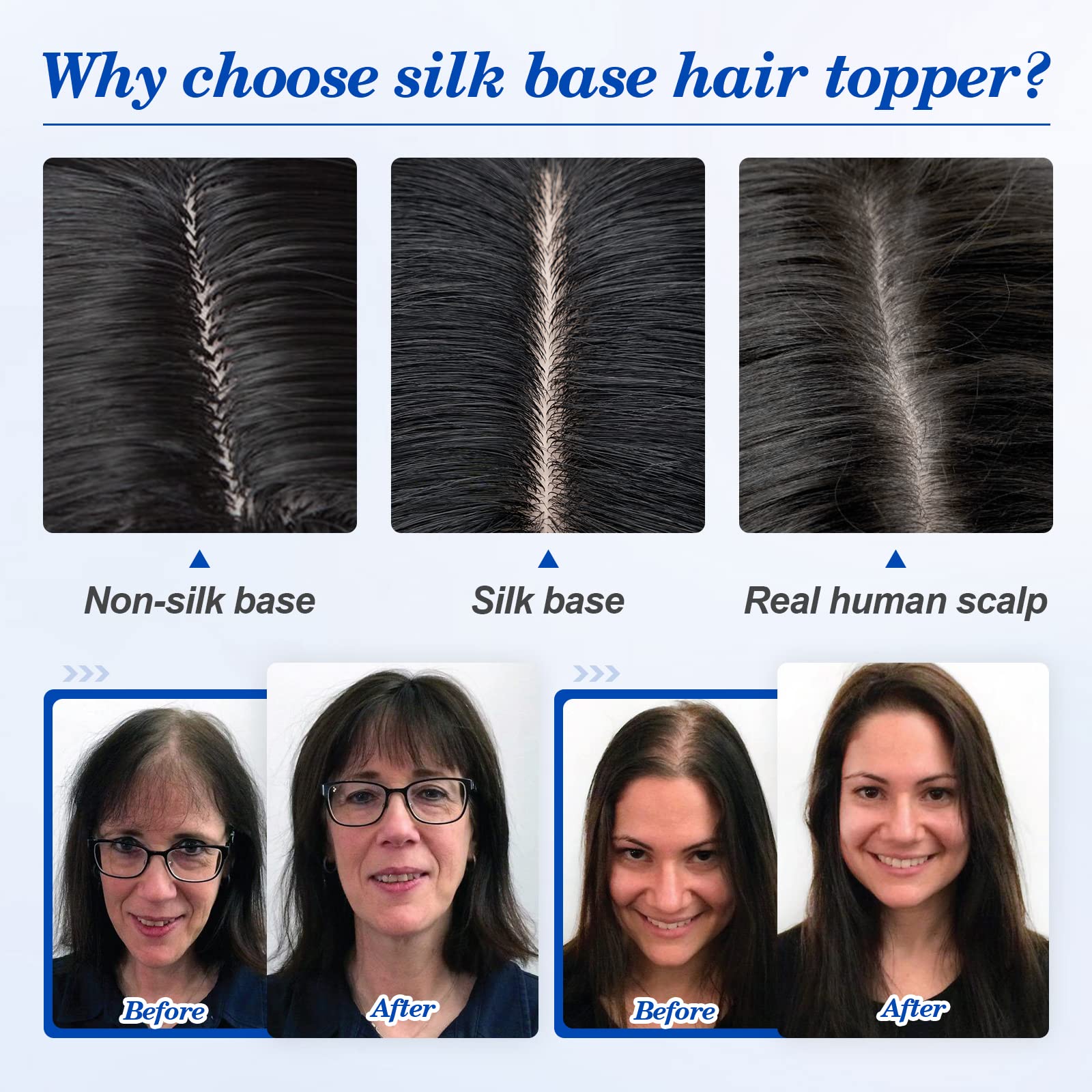 Benehair 10 Inch Real Human Hair Toppers for Women - 130% Density, 4
