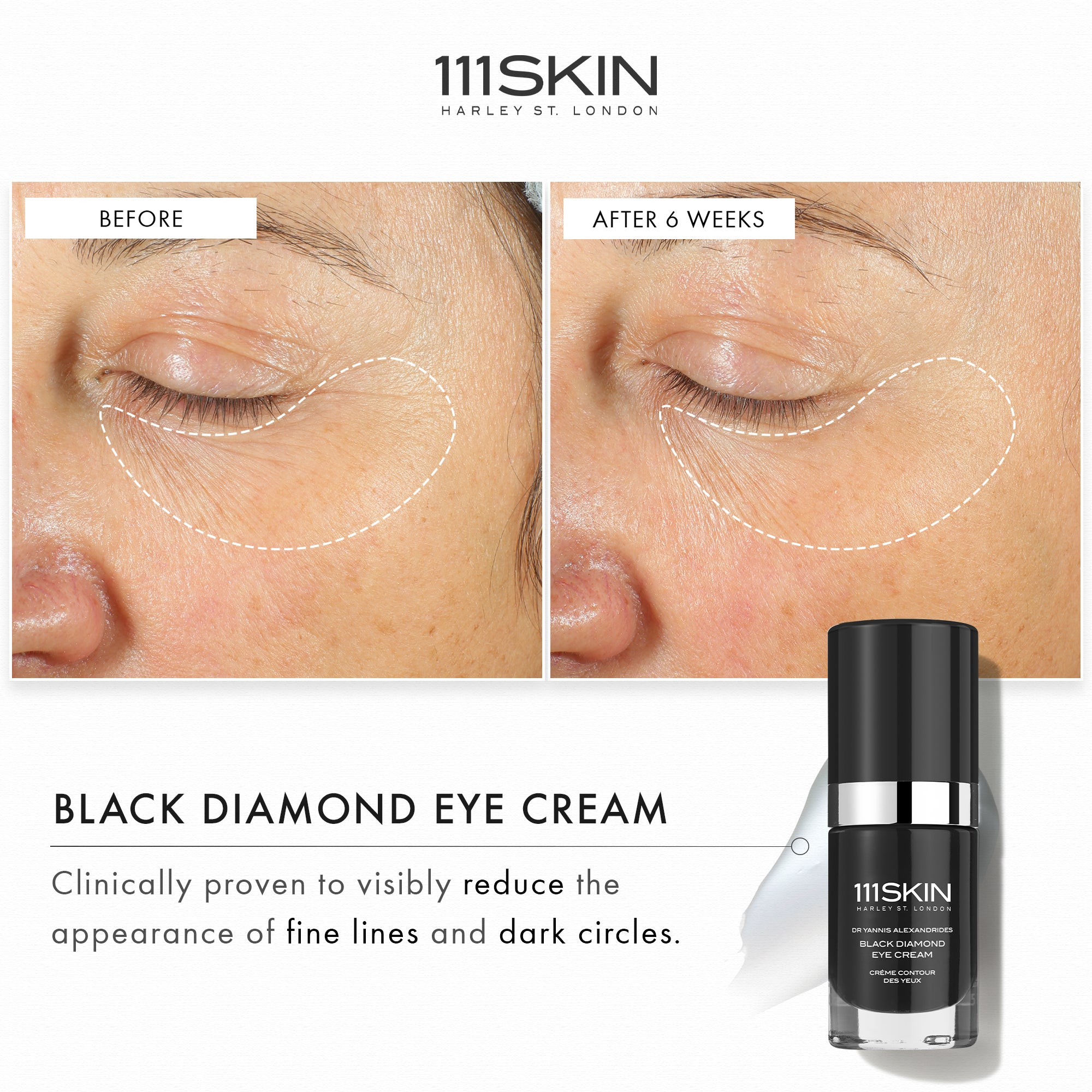111Skin Black Diamond Eye Cream - Anti-Aging & Dark Circle Treatment for Brightening & Hydration - Perfect for Nighttime Skincare Routine & Under Eye Care