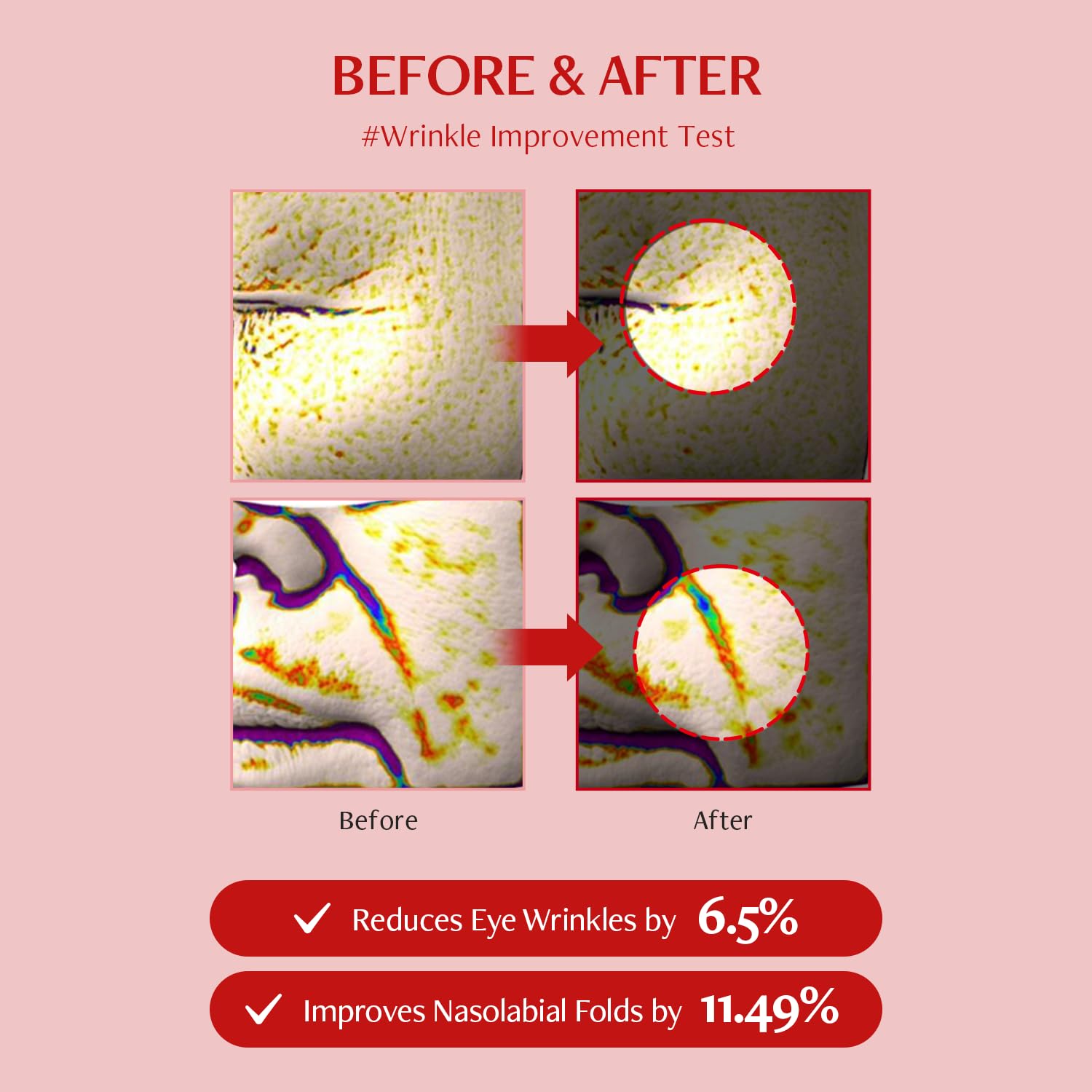 MEDITHERAPY Shumage Gold Seal Lifting Cream & Ampoule Set - Anti-Aging Face Lift Cream with Collagen, Hydrating & Tightening for Sagging Skin - Moisturizer for Radiant Glow - Perfect for Night Routine & Wrinkle Reduction