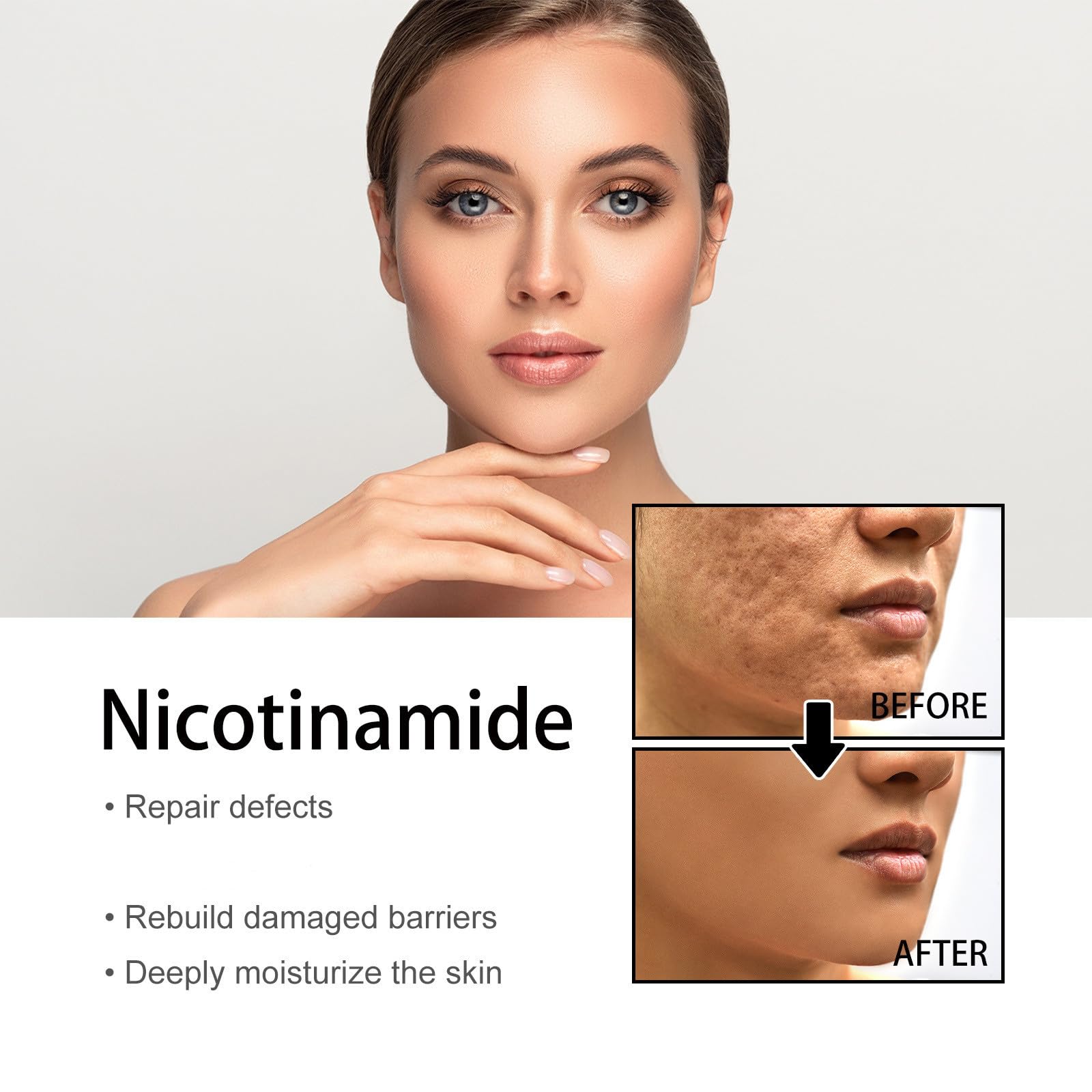 Niacinamide Serum for Freckles & Blemish Removal - Brightening Facial Treatment for Dark Spots & Hyperpigmentation | Perfect for Daily Skincare Routine & Nighttime Use