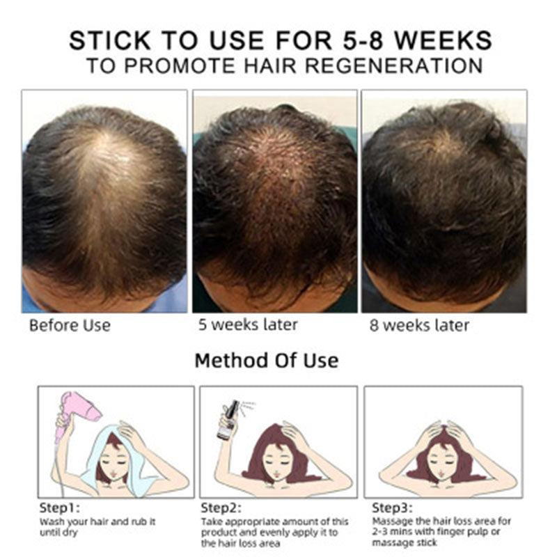 Premium Hair Growth Oil for Thicker & Longer Hair - Natural Essential Oil Treatment for Hair Care & Scalp Health - Perfect for Daily Use, Styling & Hair Loss Prevention