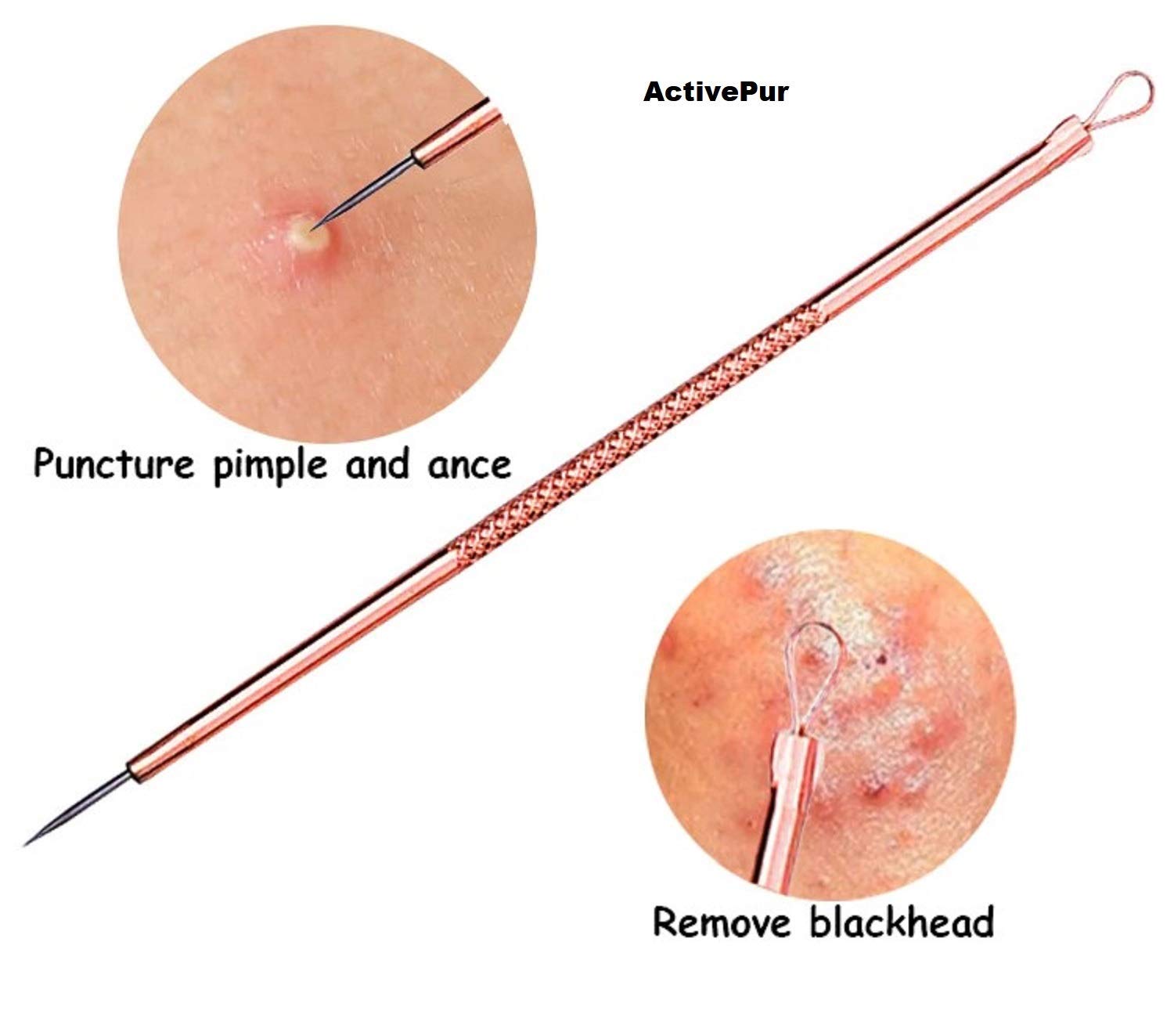 Professional Blackhead & Pimple Remover Kit - 4-Piece Acne Extractor Tool for Whitehead & Comedone Removal | Safe for Face, Nose & Skin | Includes Travel Case | Perfect for Home Skincare & Spa Treatments