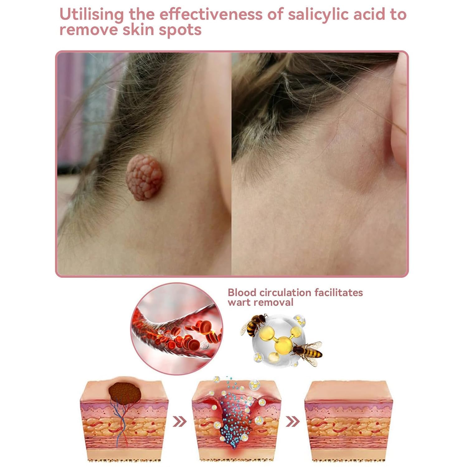 Coenzyme Q10 Collagen Jelly Cream - Intense Moisturizing Skin Care for Daily Use