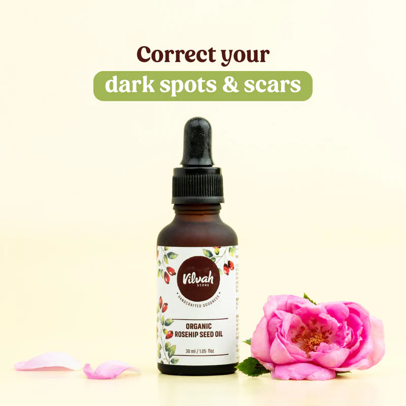 Pure Organic Rosehip Seed Oil for Face & Skin - Cold Pressed, Unrefined, 100% Natural - Anti-Aging, Moisturizing & Scar Treatment - Perfect for DIY Beauty, Massage & Aromatherapy