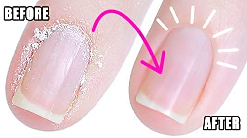 SOFSKIN (US Brand) Acetone Nail Polish Remover with Cuticle Moisturizer - Lemon Scented 3.8oz (112ml) for Professional Salon & At-Home Manicures