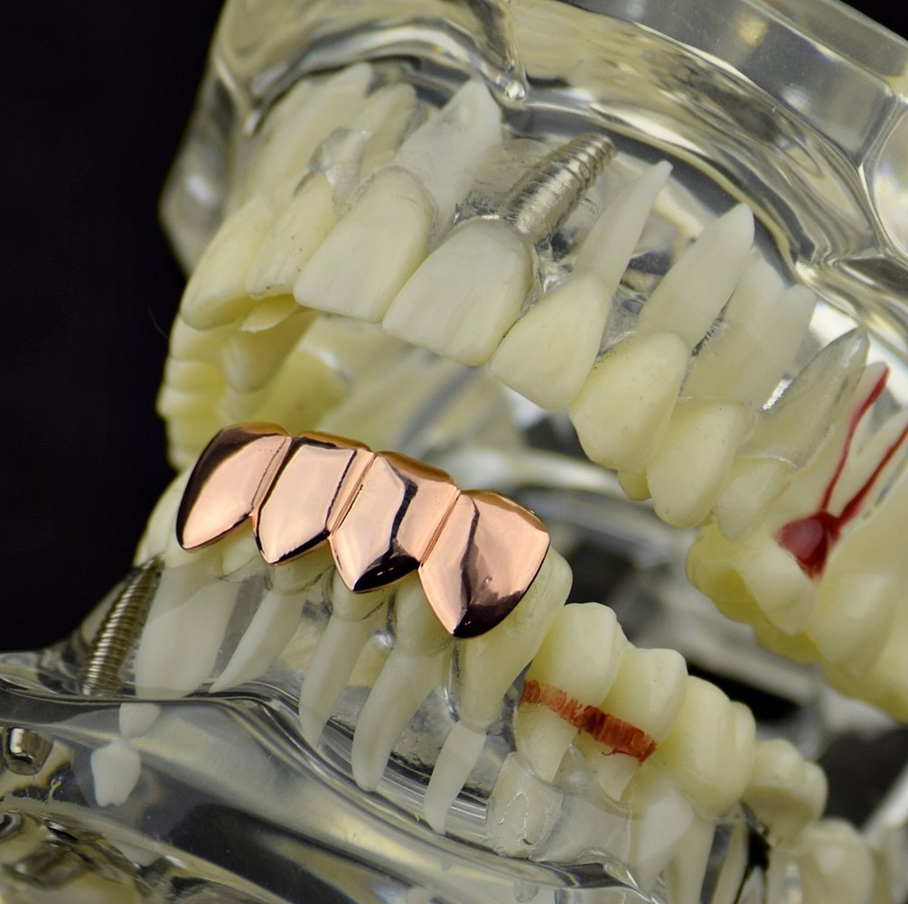 14K Rose Gold Plated Hip Hop Grillz - 4 Tooth Lower Quad Teeth Grills for Men & Women - Perfect for Rap Performances, Music Videos, and Streetwear Fashion