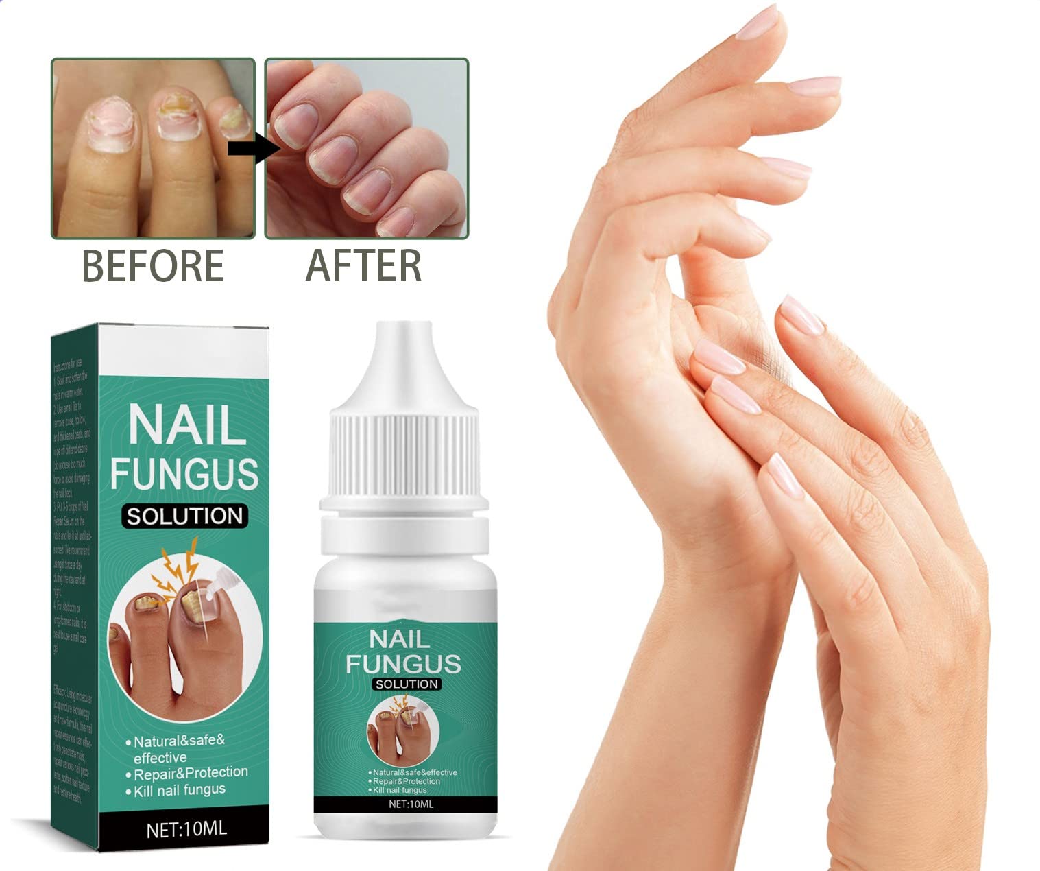 Nail Repair Essence Treatment - Strengthening & Nourishing Liquid for Damaged & Discolored Nails (3 Pack) | Perfect for Pedicures, Manicures & At-Home Nail Care
