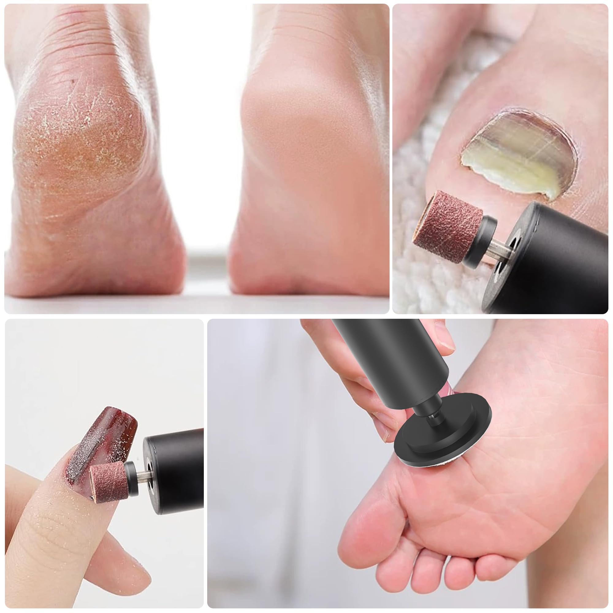 Rechargeable Electric Foot Callus Remover - Professional Pedicure Tool for Cracked Heels & Calloused Feet - Electric Foot File & Heel Scraper - Painless Dead Skin Removal - Perfect for Home Spa & DIY Foot Care (Black)