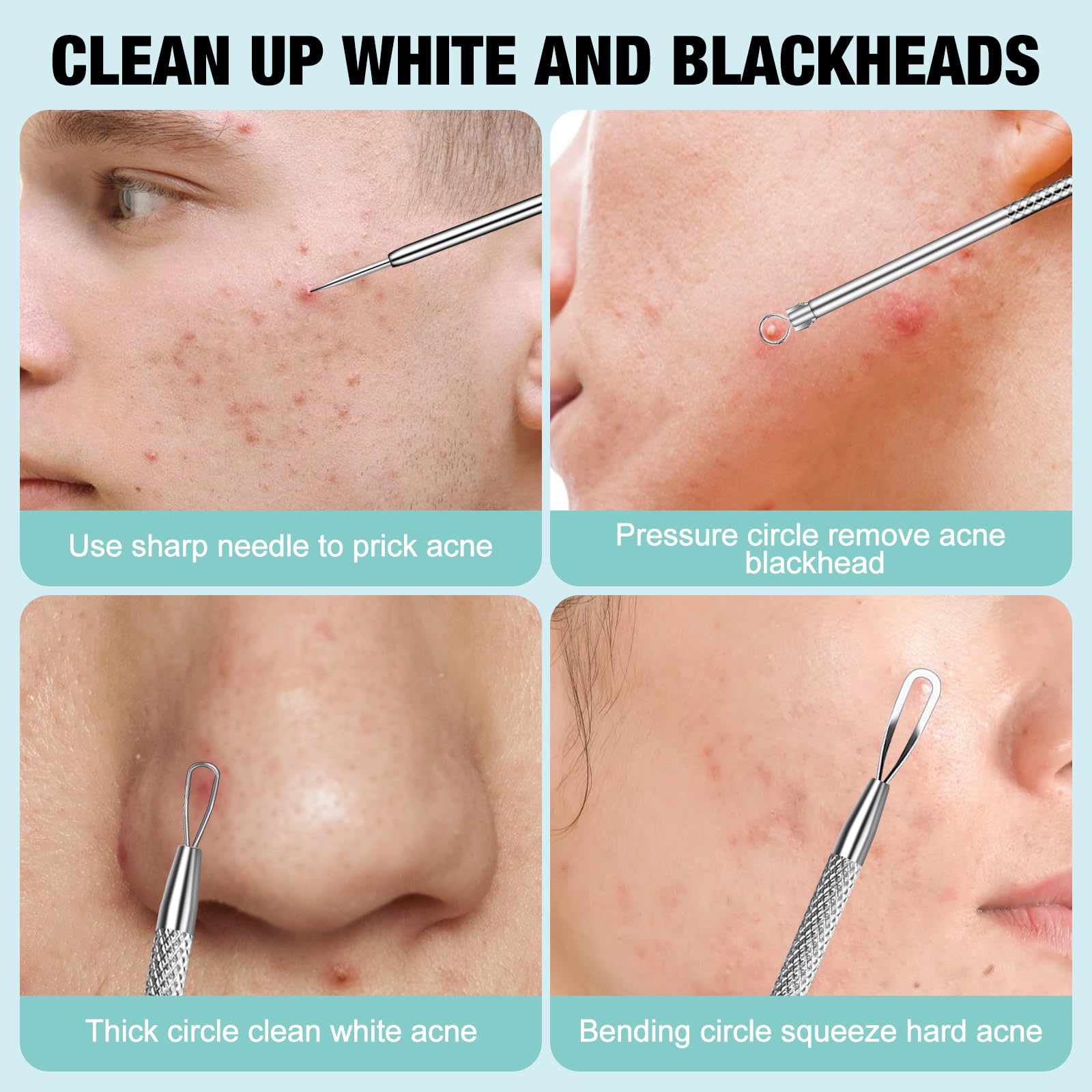 3Pcs Blackhead Remover Kit - Acne Treatment Tools for Face & Nose Care