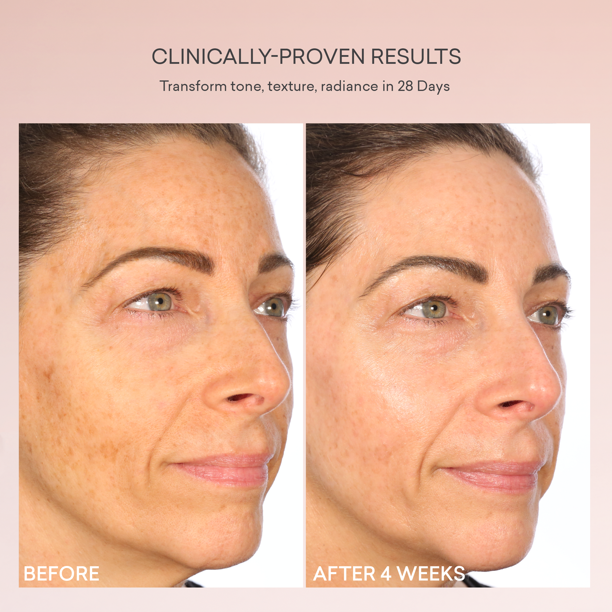Transform AHA Serum for Face - Exfoliating & Brightening Treatment with Glycolic Acid - Perfect for Acne, Wrinkles & Dark Spots - Morning & Night Skincare Routine