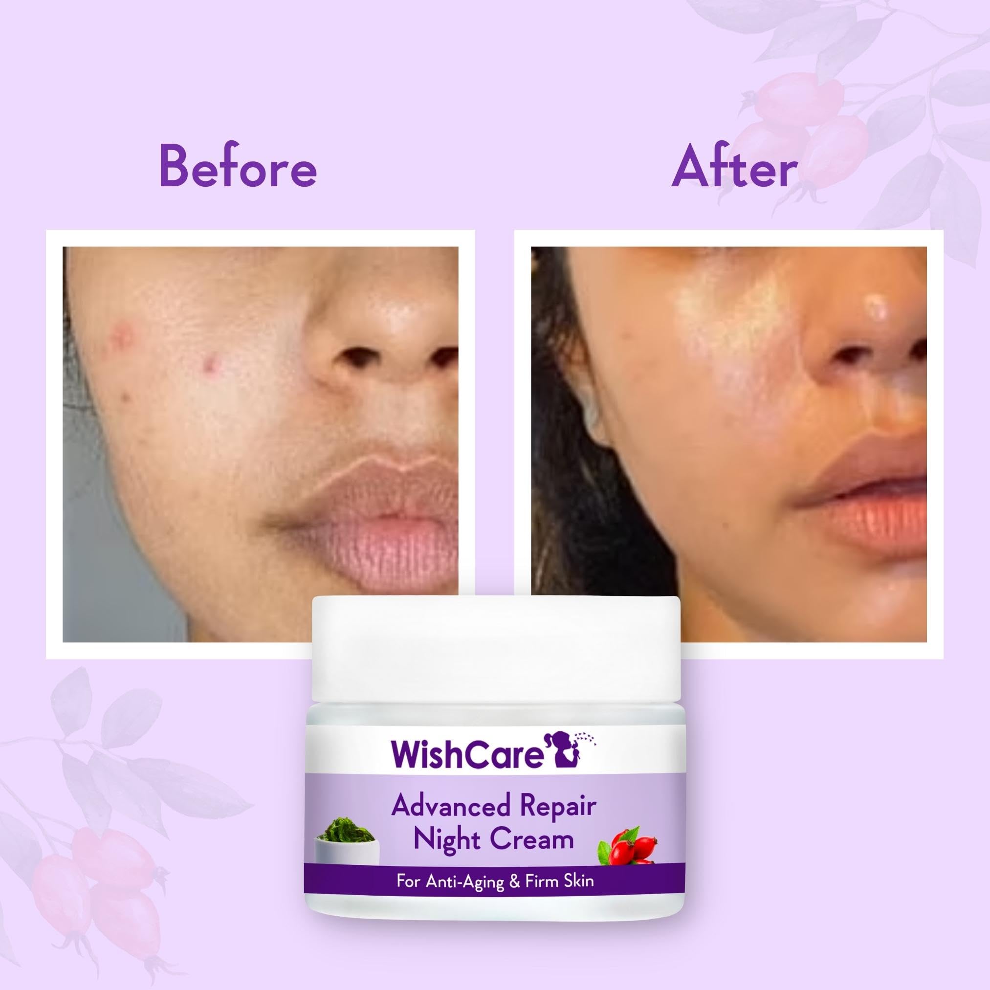 WishCare Collagen Boosting Advanced Repair Night Cream with Retinol, Niacinamide & Natural Oils - Anti-Aging, Firming & Plumping Face Moisturizer - 50g - Perfect for Nighttime Skincare Routine & Dry Skin Care
