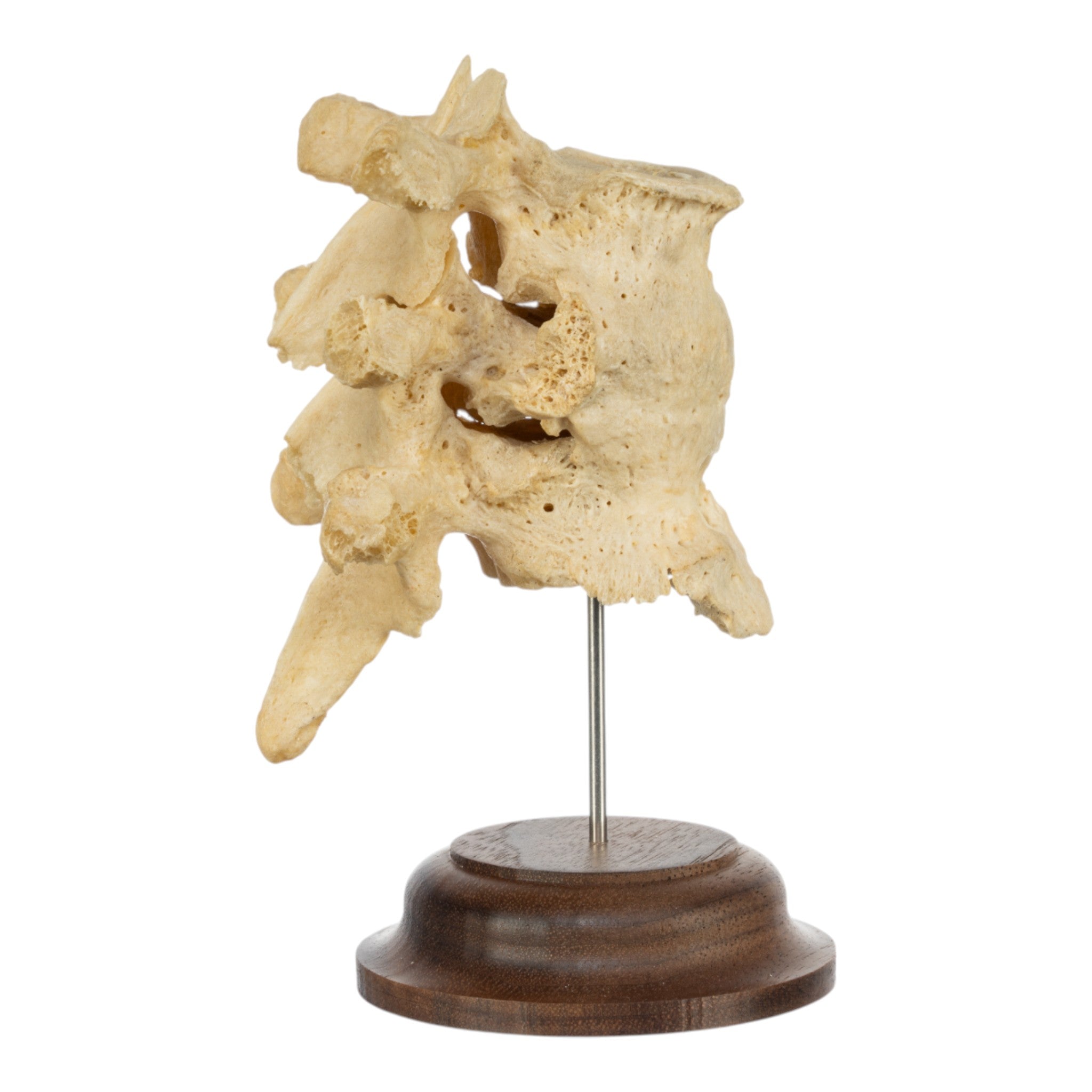 Authentic Human Fused Vertebrae Specimen - Medical Educational Display for Anatomy Study, Classroom Teaching & Doctor's Office Decoration