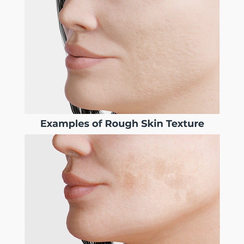 Even, Correct & Renew Retexturizing Pads - 60 Count Exfoliating Face Pads for Smooth Skin | Gentle Resurfacing Treatment for Dullness & Texture | Perfect for Daily Skincare Routine & Travel
