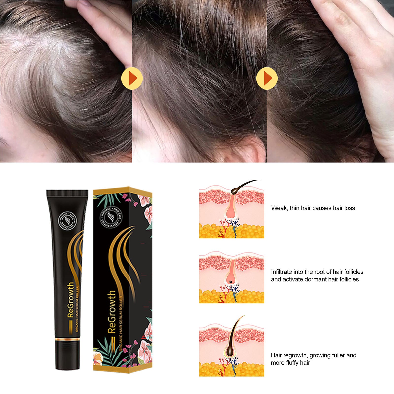 Organic Hair Growth Serum with Roller - Anti-Hair Loss Treatment for All Hair Types, Scalp Nourishing & Strengthening - Perfect for Thinning Hair & Daily Hair Care Routine