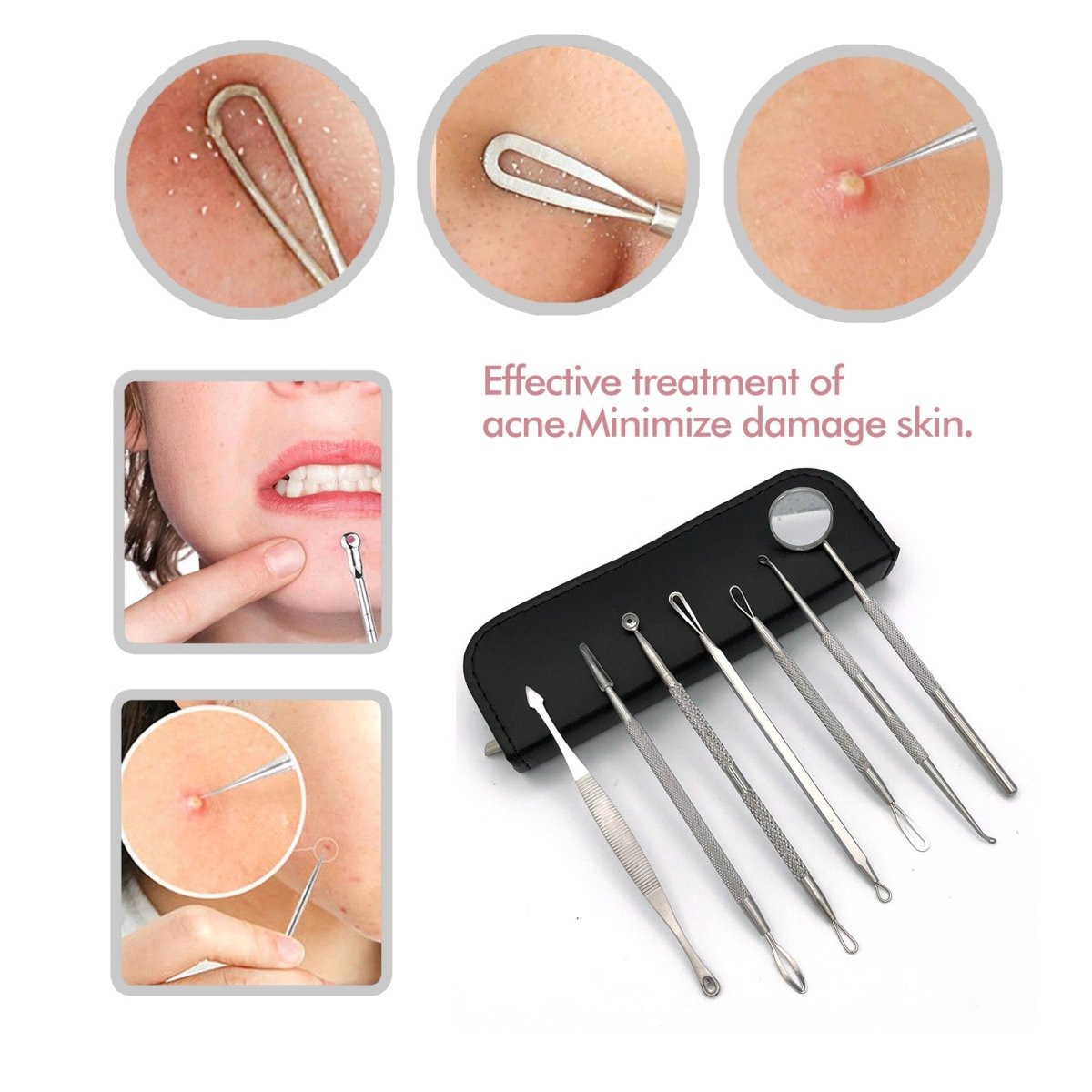 Professional Acne Removal Tool Kit - Blackhead & Pimple Extractor Set for Face & Body Care - Perfect for Home Skincare Routine & Spa Treatments