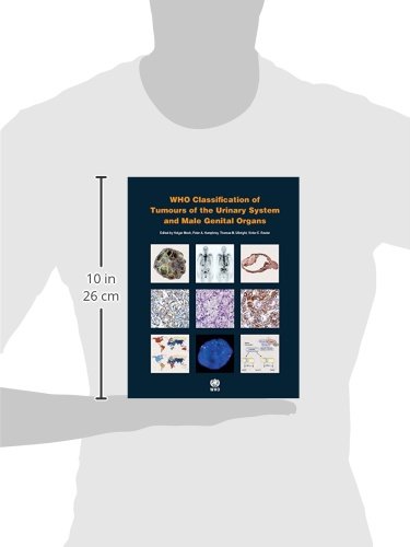 WHO Classification of Tumours of the Urinary System and Male Genital Organs - Comprehensive Medical Reference Book for Urologists, Pathologists & Oncologists | Essential for Cancer Diagnosis, Research & Clinical Practice