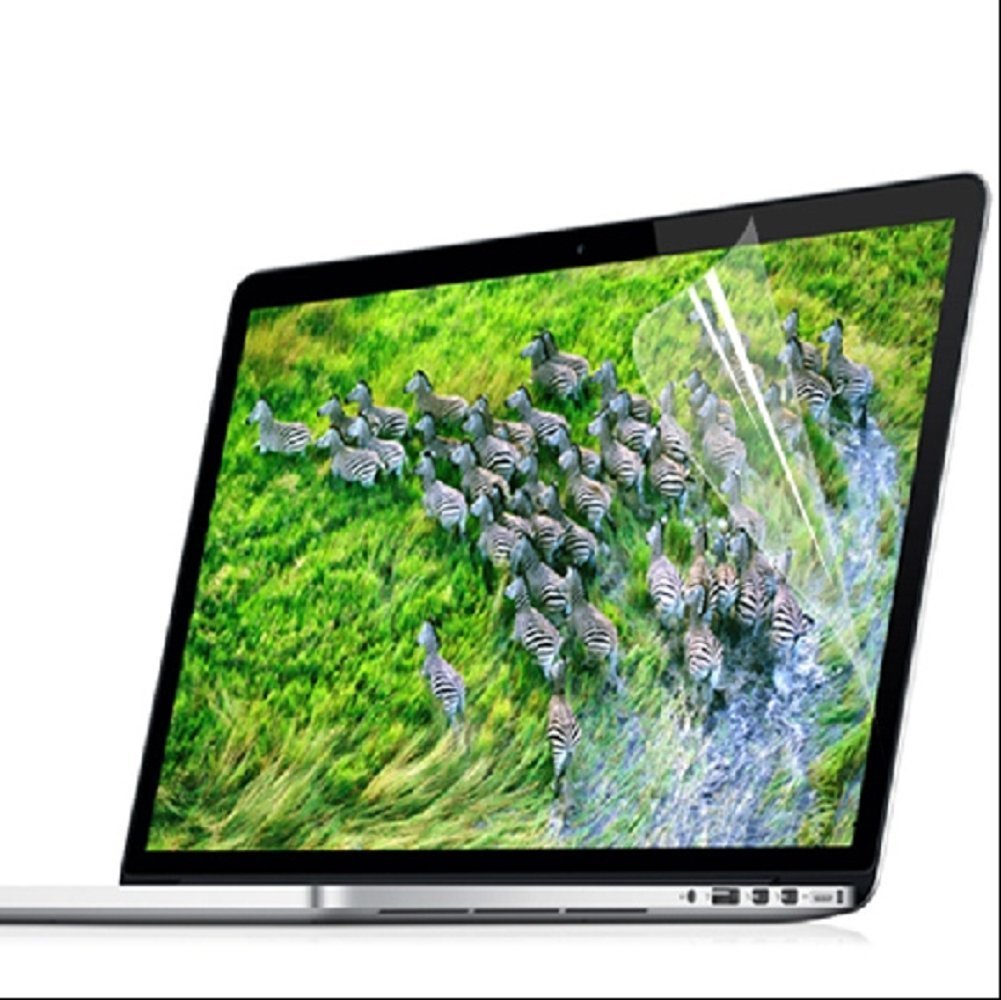 Se7enline Hard Shell Case Cover for MacBook Pro 15 inch A1286 (2010-2012 Models with DVD Drive) - Includes Sleeve Bag, Keyboard Cover, Screen Protector & Dust Plugs - Aqua Green - Perfect for Work, Travel & School Protection
