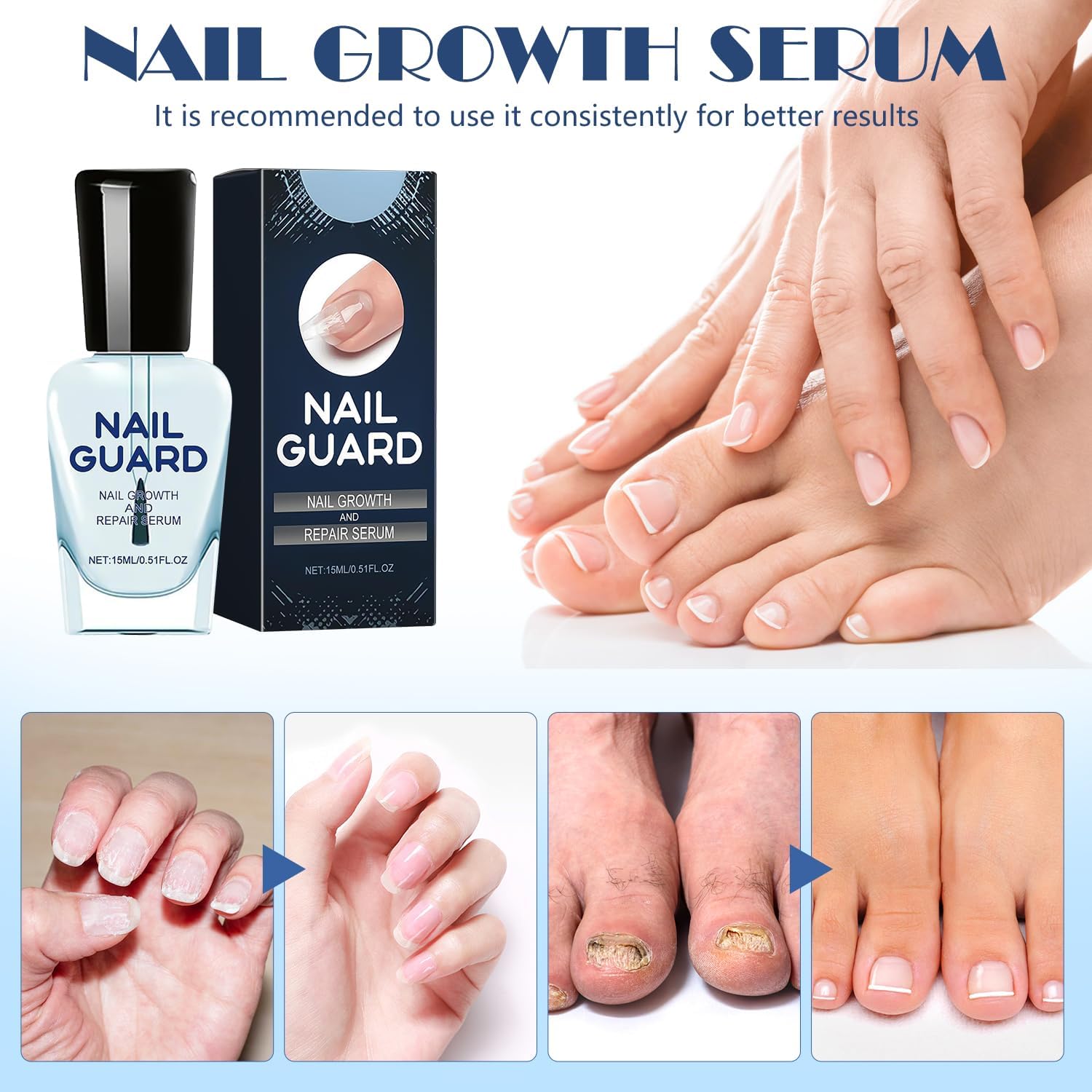 2Pcs Onyxoguard Nail Growth & Repair Serum - Nail Strengthener Treatment for Thin & Brittle Nails - Promotes Healthy Nail Growth - Perfect for Manicures, Pedicures & Nail Care Routine