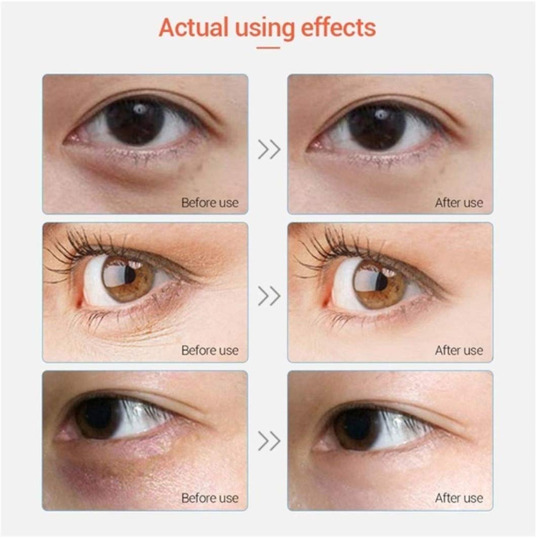 Collagen Under Eye Patches - 30 Pairs Anti-Aging Eye Mask for Puffy Eyes & Dark Circles, Hydrating Gel Eye Pads for Wrinkles & Fine Lines | Perfect for Morning Skincare Routine & Travel Beauty Essentials