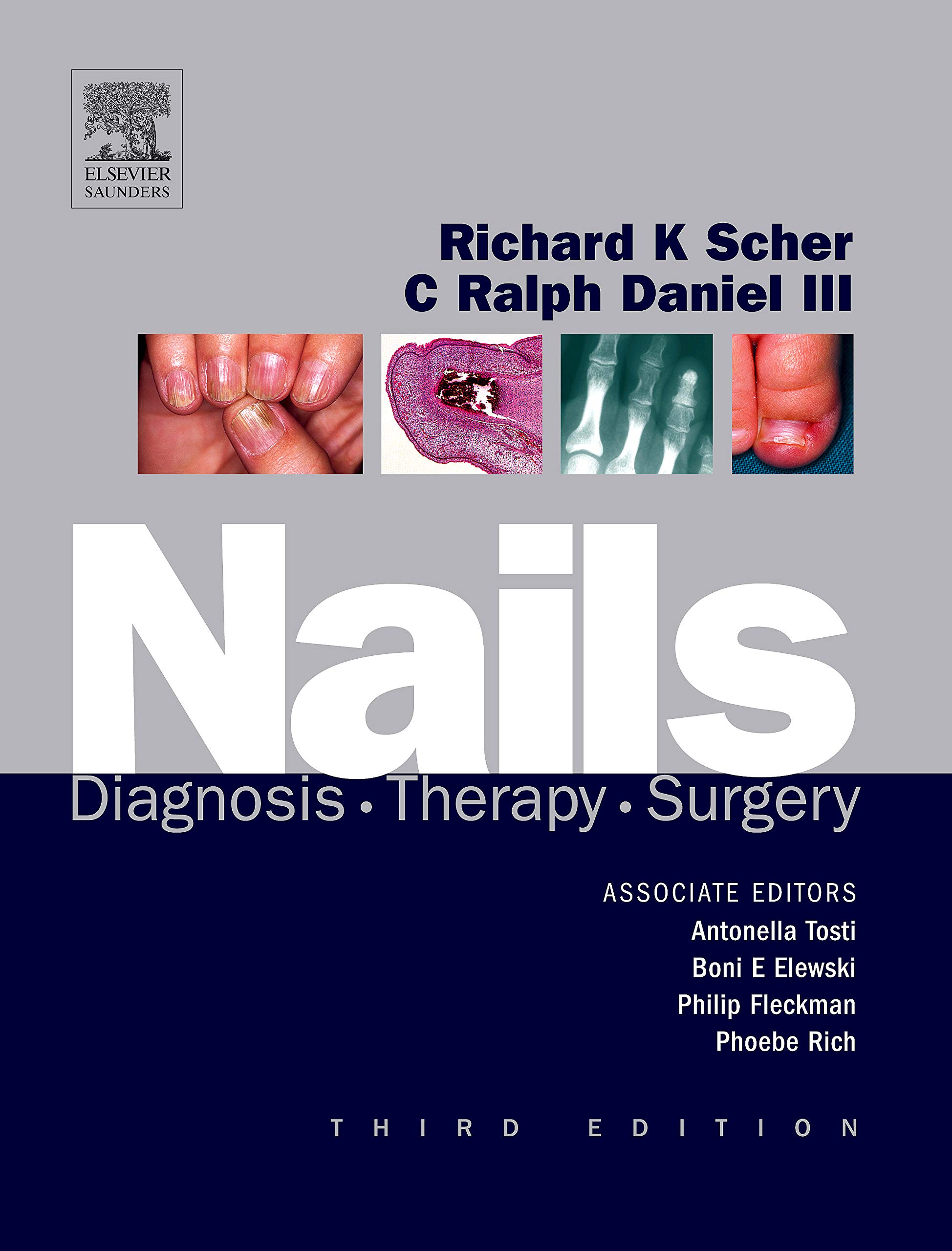 Nail Care Products: Diagnosis, Treatment & Surgery Solutions for Healthy Nails | At-Home & Professional Use