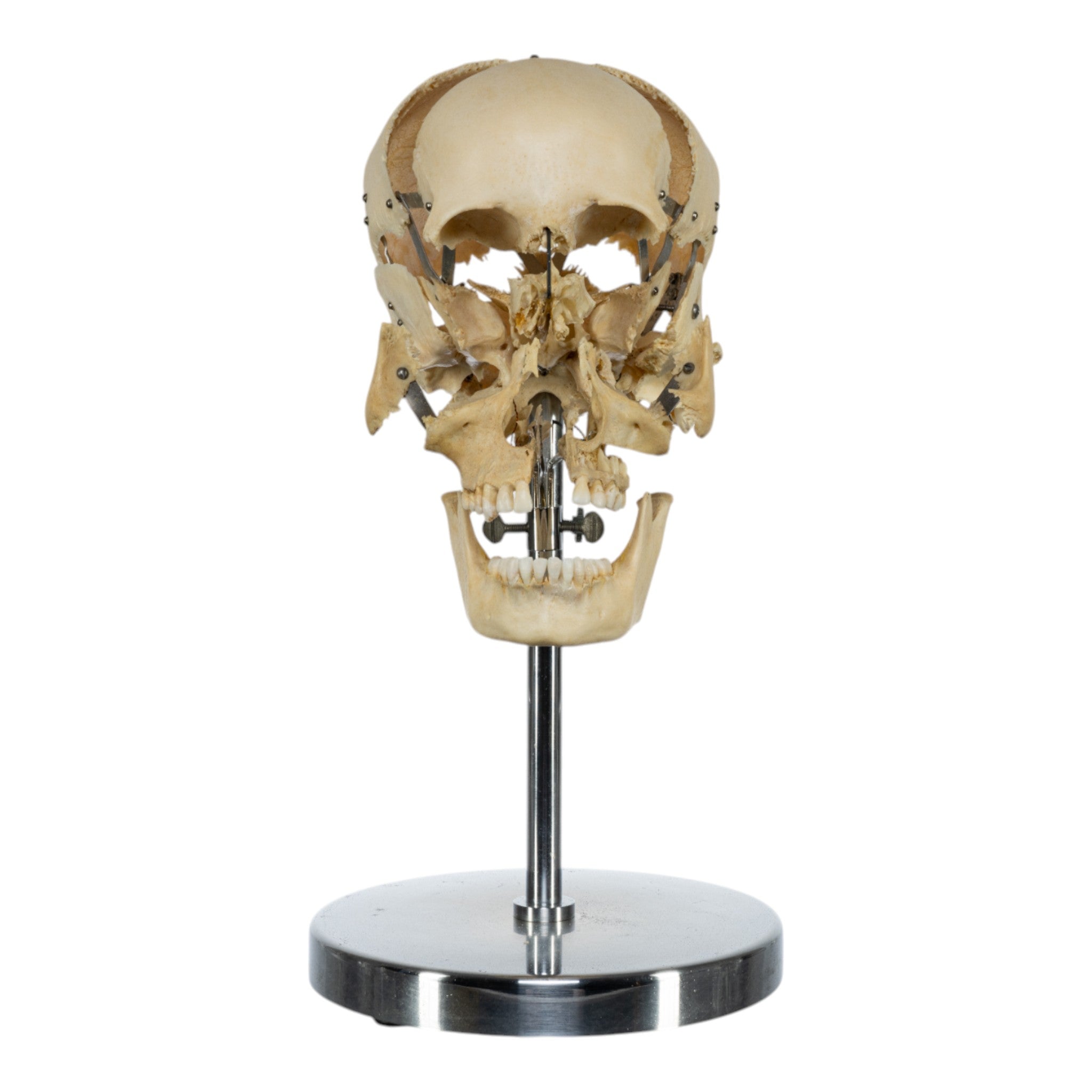 Real Human Exploded Skull Model on Display Stand - Perfect for Anatomy Study, Medical Education & Halloween Decor