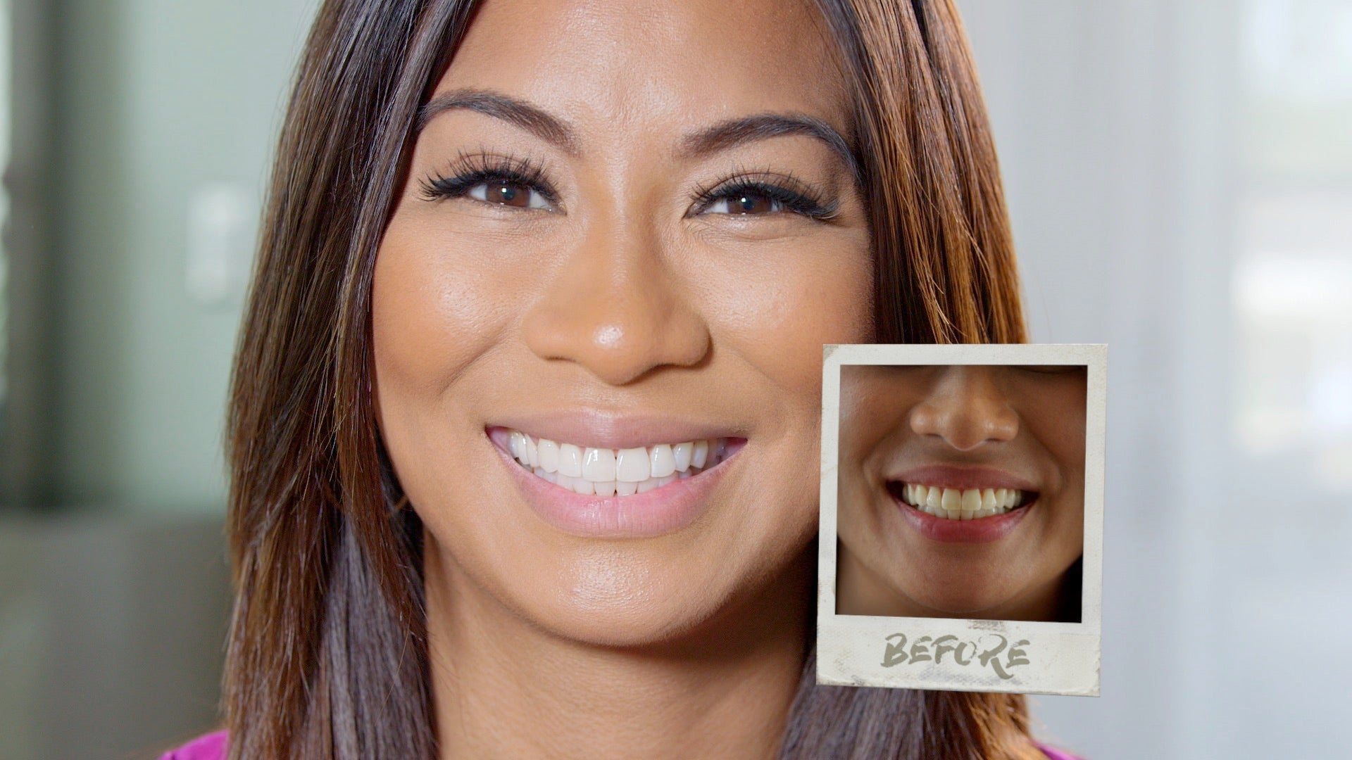 Innovawhite Teeth Whitening Kit - Professional Teeth Whitening Pen & LED Light for Brighter Smile at Home or On The Go
