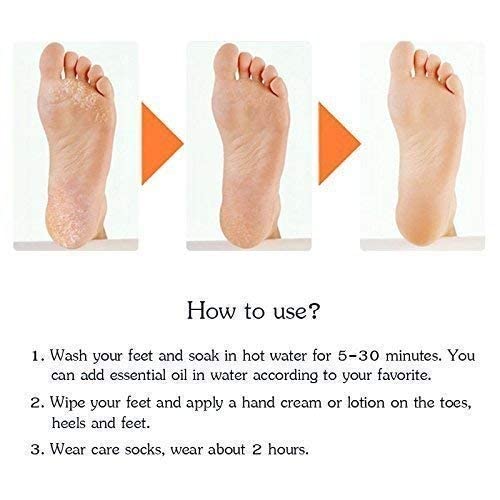 Dabster Anti Crack Heel Silicone Gel Foot Protector Socks - Moisturizing & Pain Relief for Cracked Feet, Heel Pads for Women - Perfect for Overnight Foot Care, Dry Skin Repair & Comfortable Daily Wear