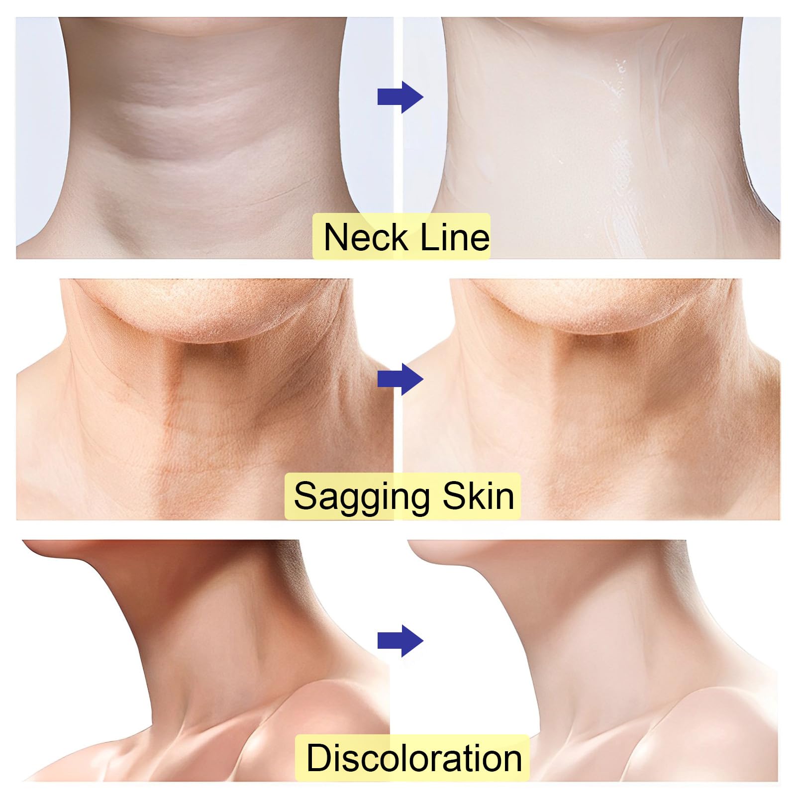 Anti-Aging Neck Firming Cream - Tightening & Lifting Treatment for Sagging Skin | Moisturizing Neck Cream for Crepey Skin & Wrinkles | Daily Skincare Routine for Youthful Neck & Décolleté