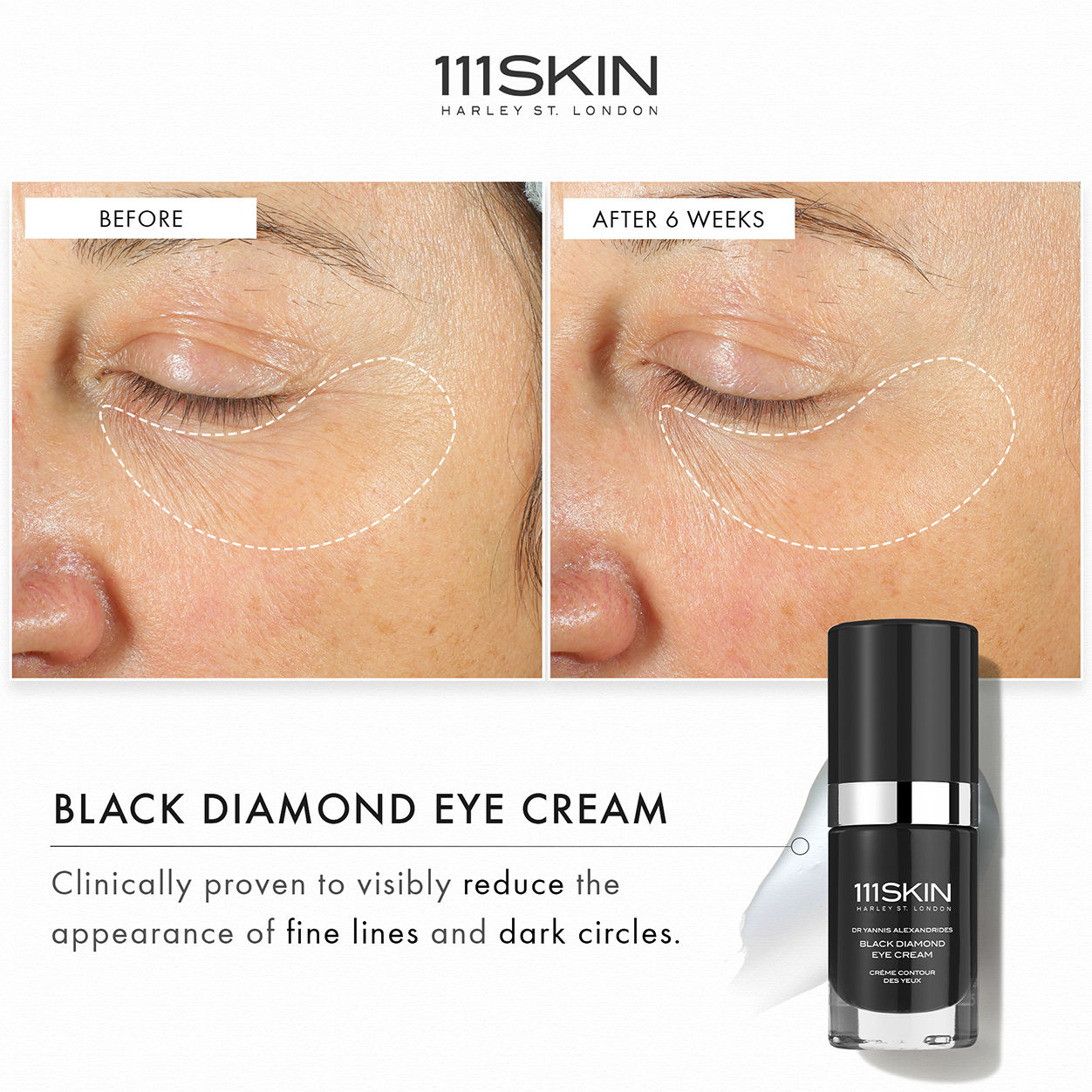 Black Diamond Eye Cream for Dark Circles & Wrinkles - Anti-Aging Under Eye Treatment for Puffiness & Fine Lines - Perfect for Night & Day Use