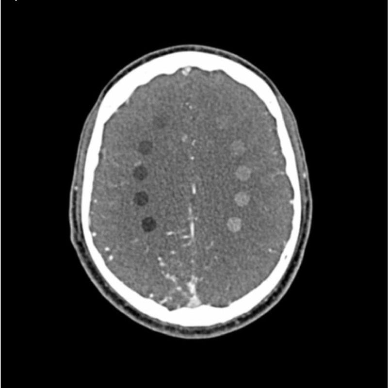 CTA AVM / Lesion Head and Neck Phantom for CT Scan & X-Ray Training - Medical Imaging Practice, Radiology Education, and Diagnostic Procedure Simulation
