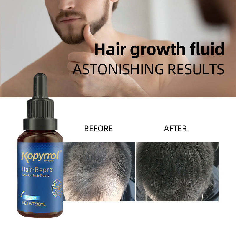 Best Hair Care Lotion for Men & Women - Strengthens Hairline & Promotes Growth | Daily Use for Thicker, Healthier Hair