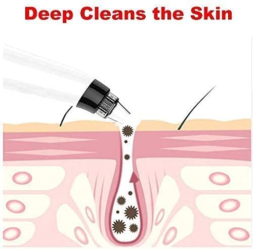 BEAMBOX 4-in-1 Blackhead Remover Vacuum Kit - Professional Pore Cleaner & Acne Treatment for Men & Women - Skin Care Tool for Blackhead Removal, Pimple Extraction & Facial Cleansing - Perfect for Home Spa & Daily Skincare Routine