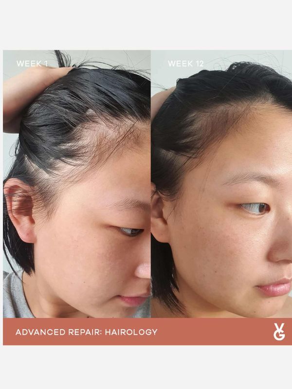 Vida Glow Hairology - Natural Marine Collagen Hair Growth Supplement for Stronger, Healthier Hair - Perfect for Thinning Hair & Hair Loss Treatment at Home