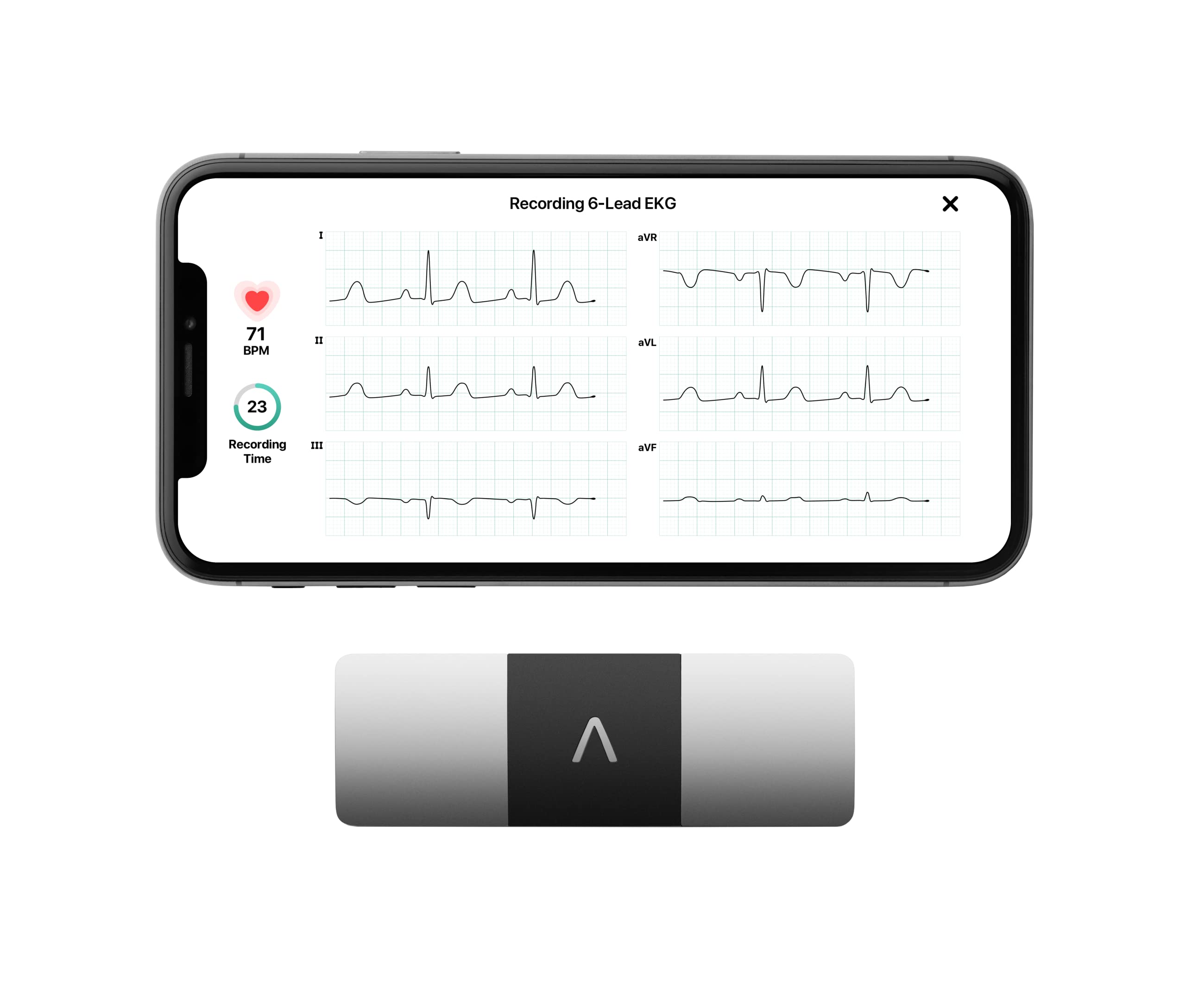 KardiaMobile 6-Lead Personal EKG Monitor – Portable Heart Rhythm Detector for AFib & Arrhythmias – 30-Second Instant Results – Compatible with Most Smartphones – FSA/HSA Eligible – Perfect for Home Health Monitoring & Travel Cardiac Care