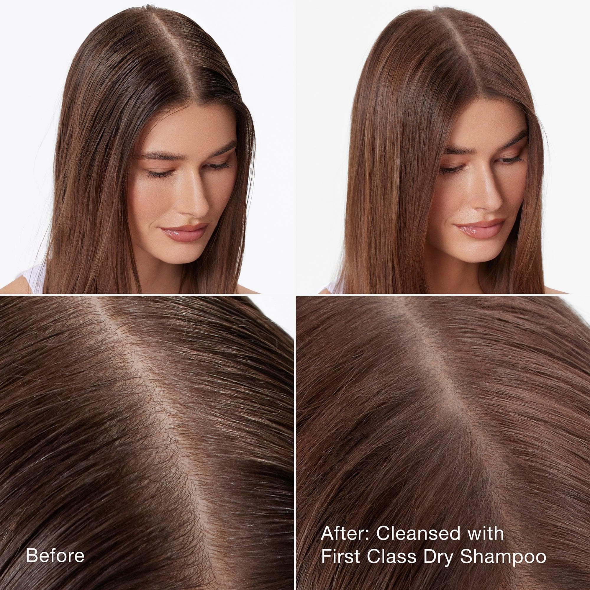 Best Dry Shampoo for Oily Hair - Volumizing & Refreshing First Class Dry Shampoo Spray - Quick Hair Care Solution for Travel, Gym & Busy Mornings