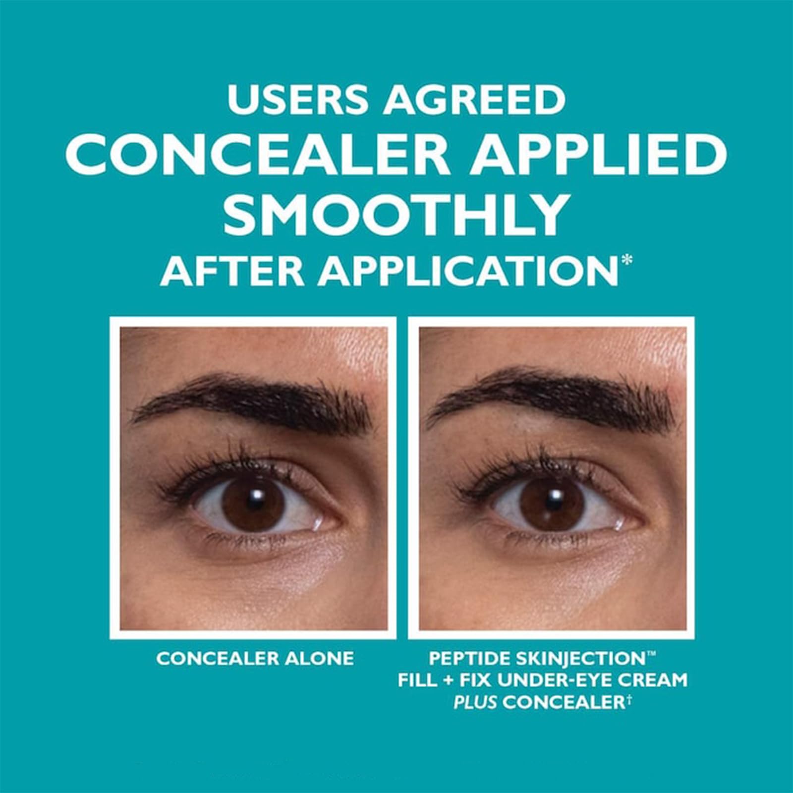 **Peptide Under-Eye Cream for Dark Circles & Wrinkles – Anti-Aging Eye Serum to Reduce Puffiness, Fine Lines & Firm Skin – Fill + Fix Skinjection Treatment (1PC) – Perfect for Nighttime Skincare & Travel**