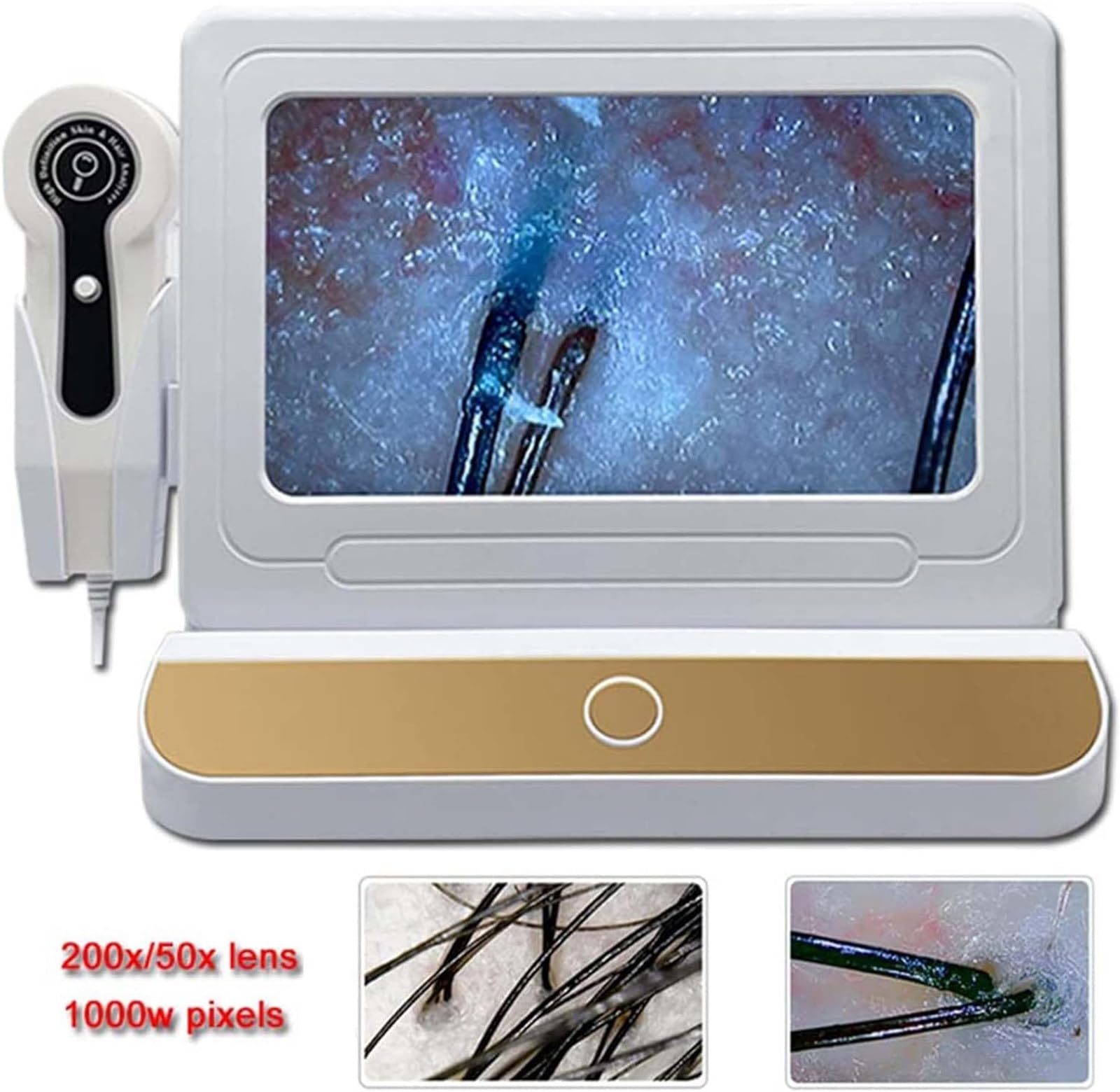 Professional HD Scalp & Hair Analyzer with 10