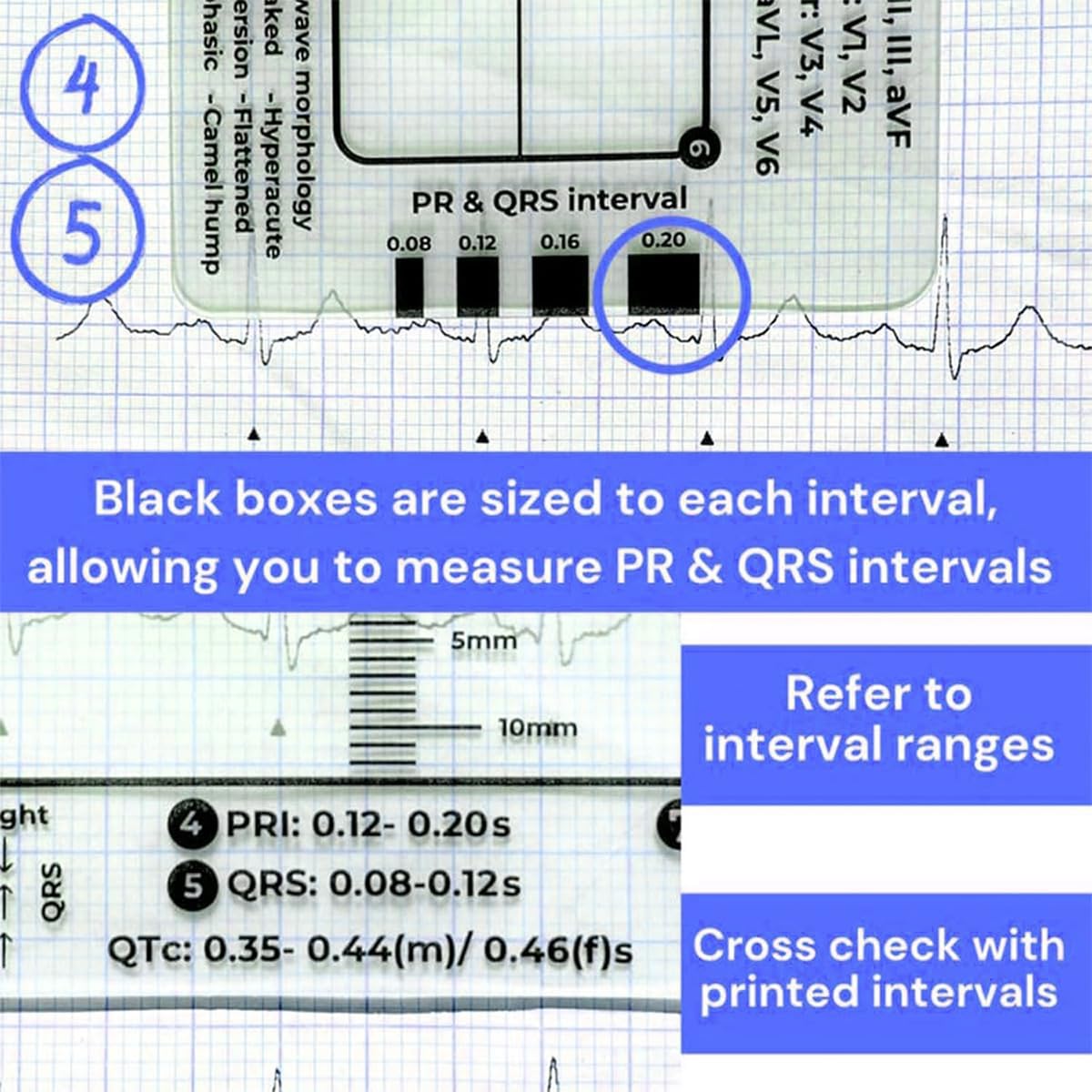 7-Step ECG Ruler for EKG Interpretation - Transparent Plastic Measuring Tool with Calipers, Portable Medical Reference Guide (2-Pack) - Perfect for Nurses, Medical Students & Healthcare Professionals