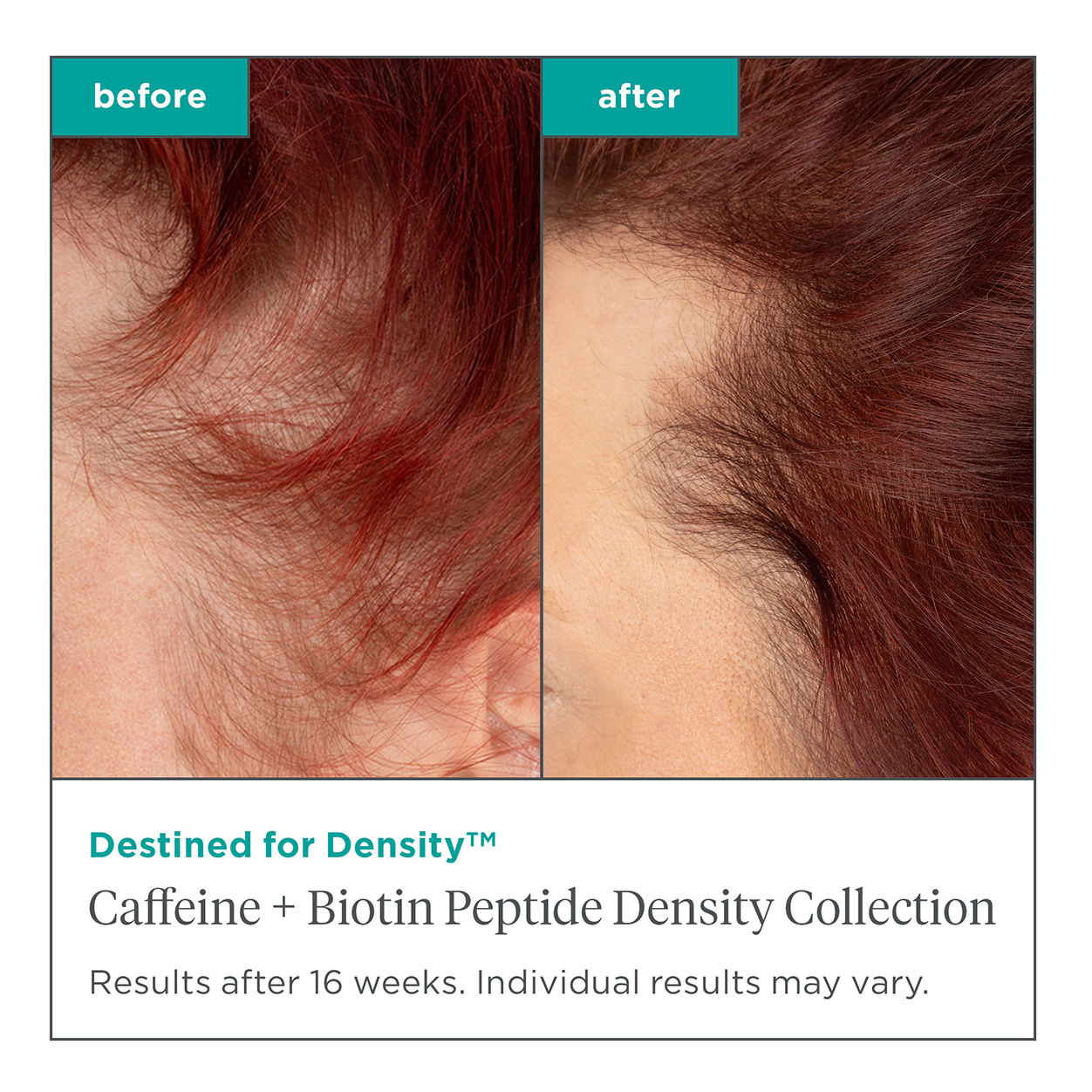 Destined for Density Caffeine & Biotin Peptide Hair Thickening Conditioner for Thinning Hair - Promotes Hair Growth & Volume for Men & Women - Perfect for Daily Use & Hair Care Routine