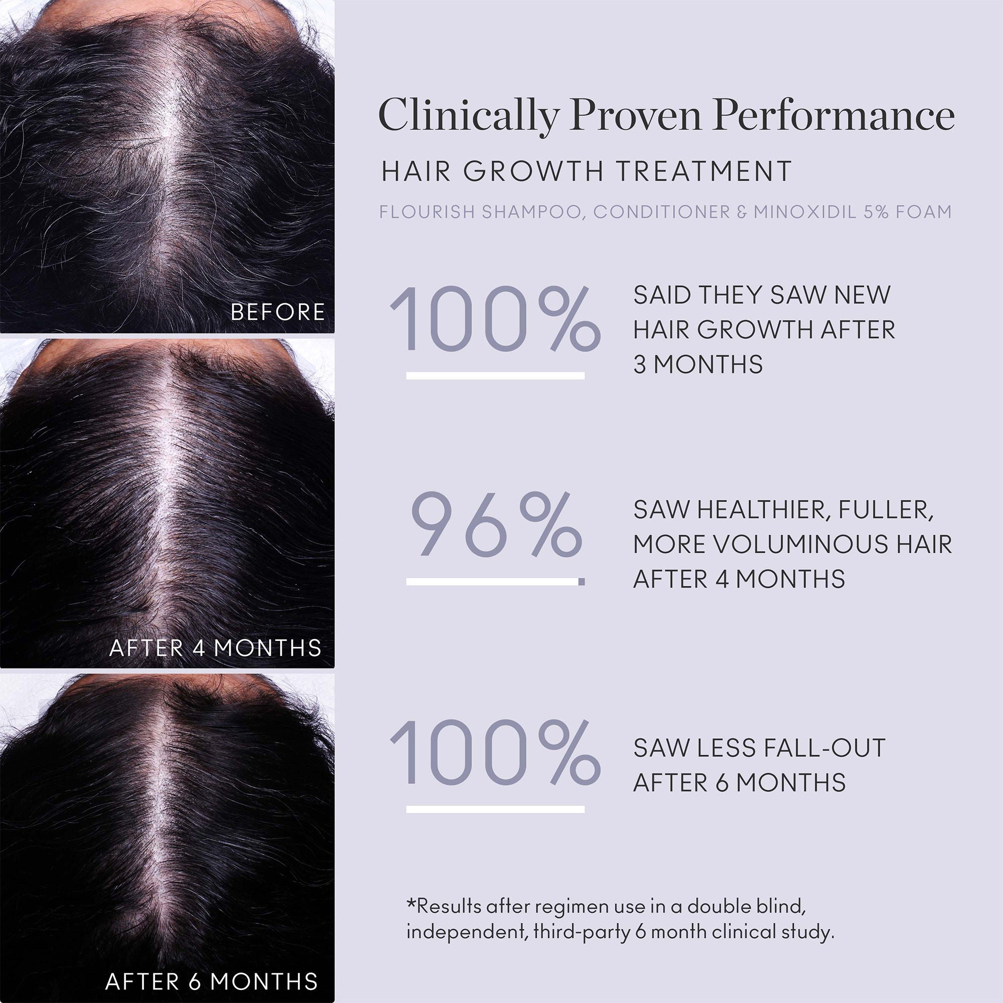 Flourish Nightly Intensive Hair Growth Treatment for Thicker & Longer Hair - 90 Day Supply | Perfect for Nighttime Hair Care Routine & Scalp Nourishment