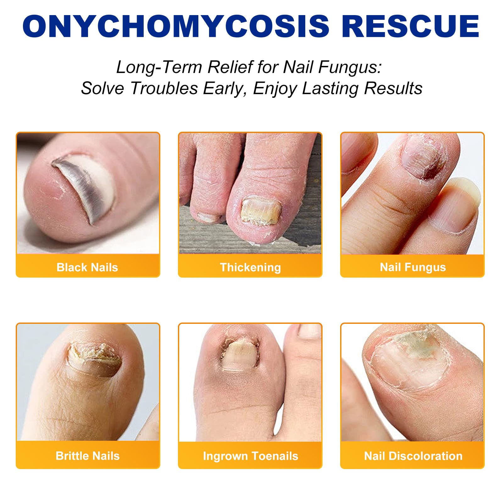 Toenail Fungus Treatment - 8 Hour Overnight Renewal Fungal Nail Patches (32 Count) - Effective Solution for Toenail Fungus Infection & Nail Repair - Perfect for Nighttime Use While Sleeping