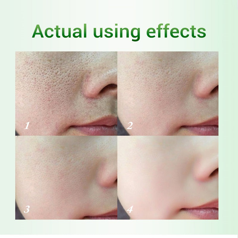 Salicylic Acid Pore Minimizing Cream - Exfoliating Face Moisturizer for Acne Prone Skin | Skin Rejuvenation & Brightening Treatment | Perfect for Daily Skincare Routine & Blemish Control