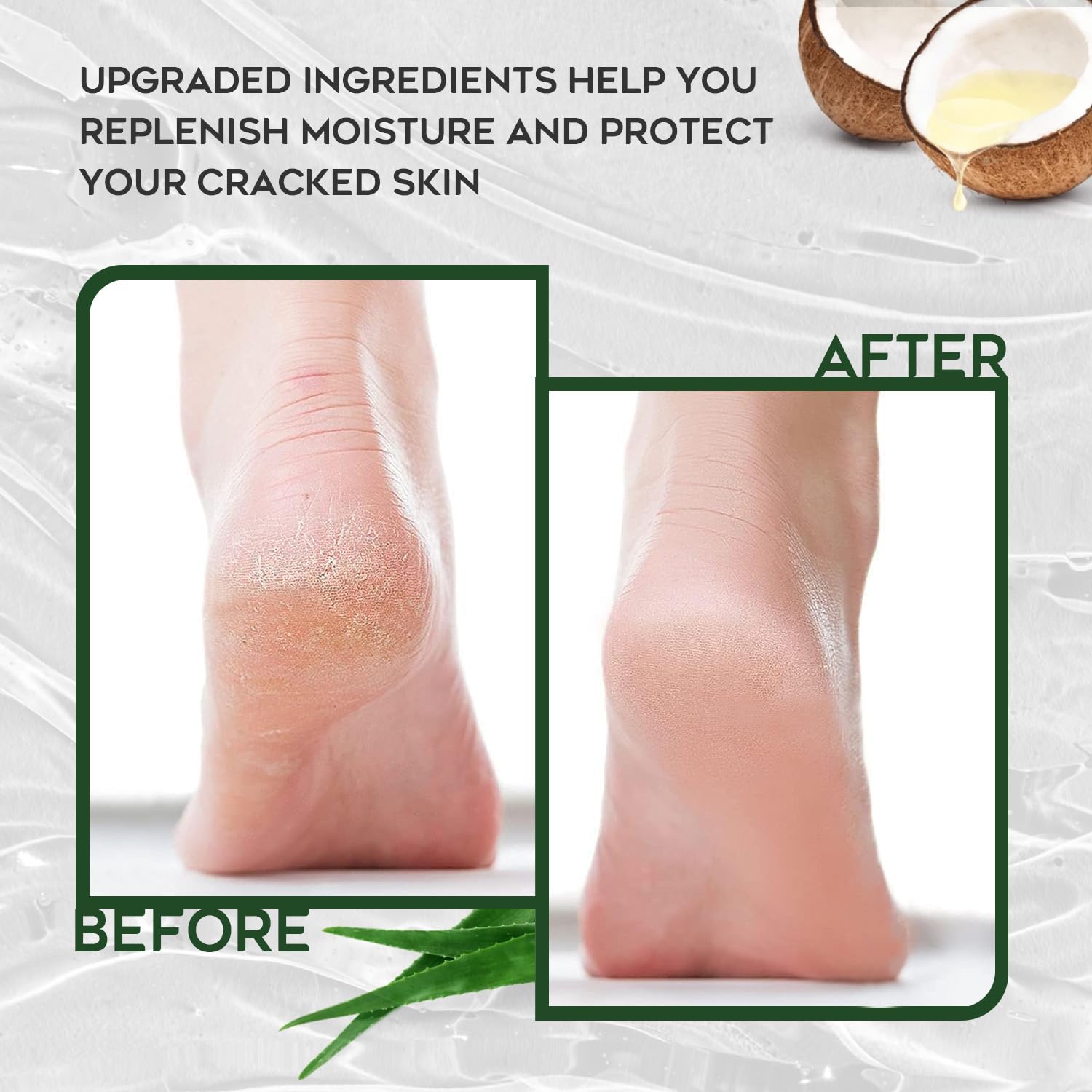 42% Urea Cream with Salicylic Acid - 4oz Callus Remover for Feet, Knees & Elbows | Intensive Moisturizer & Skin Softener | Dead Skin Exfoliator | Perfect for Dry, Cracked Heels & Rough Skin Care at Home