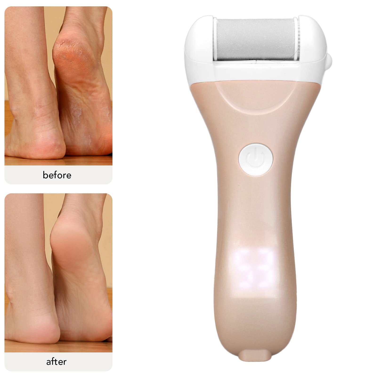 Rechargeable Electric Foot File Callus Remover - Portable Pedicure Kit with 2 Roller Heads for Dead, Cracked & Dry Skin - Perfect for Home Foot Care & Salon Pedicures