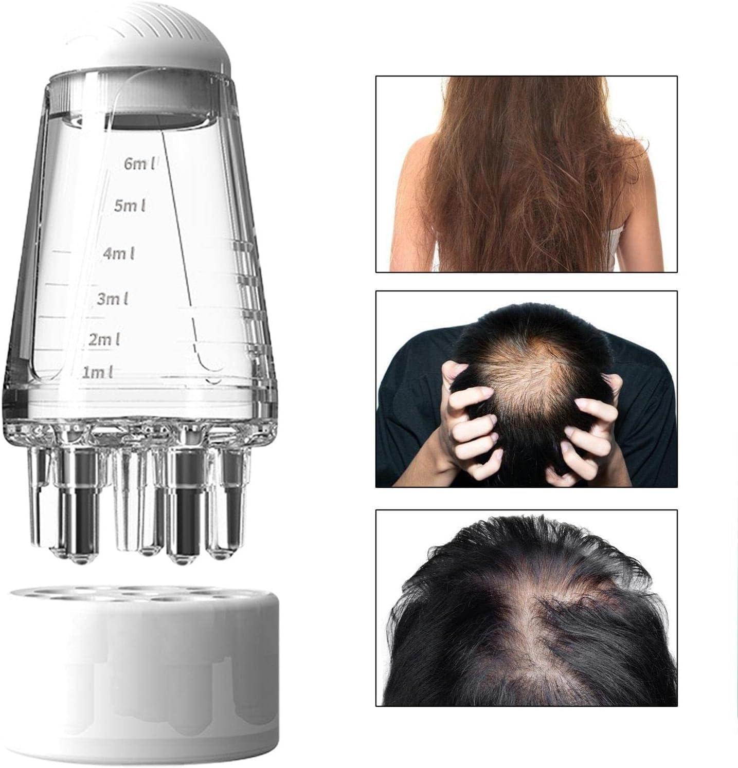 MRIYA 6ml Mini Portable Hair Oil Applicator Bottle - Essential Oil Roller Ball Scalp Massage Comb for Hair Growth Treatment, Travel-Friendly Hair Root Applicator for Oils & Serums (Perfect for Home, Travel & Salon Use)