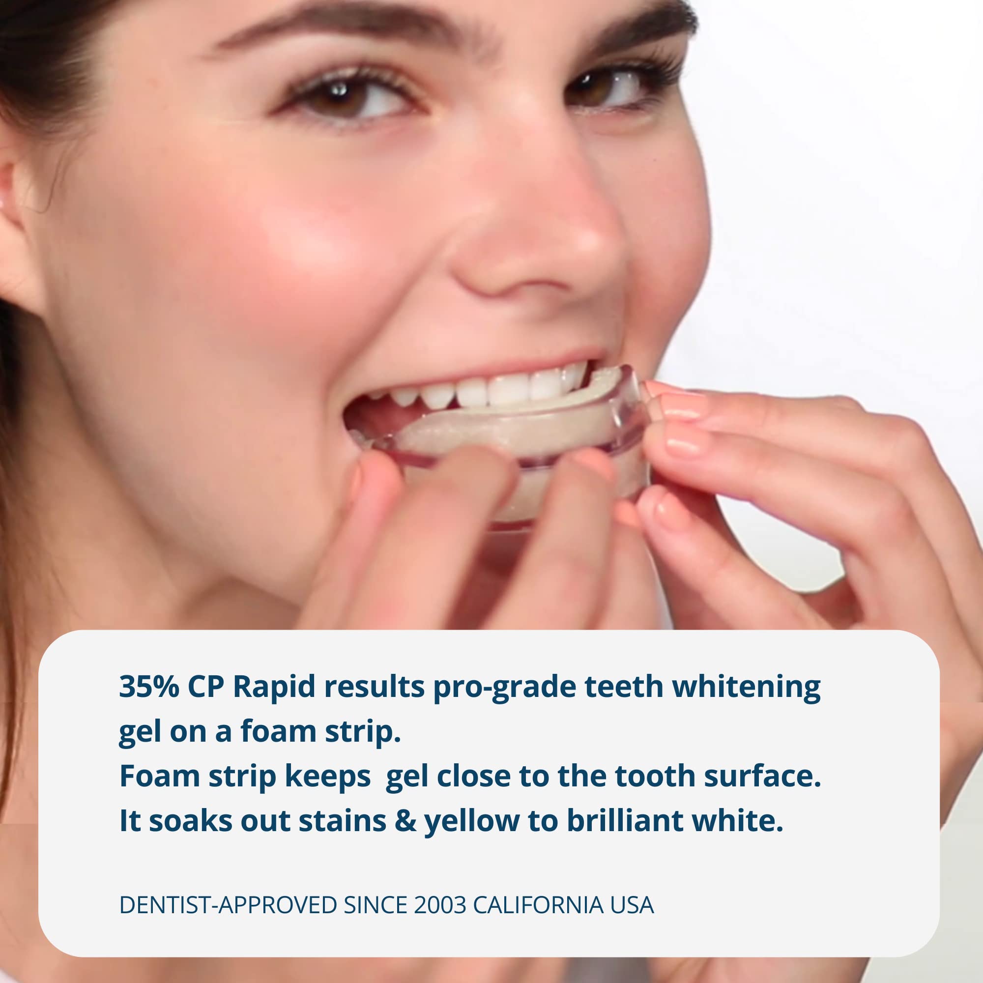 35% Preloaded Teeth Whitening Trays for Home Use - 5 Individually Sealed Trays with Professional Strength Whitening Gel - Fast 30 Minute Daily Treatment - Perfect for Wedding, Job Interview & Special Occasion Smile Brightening