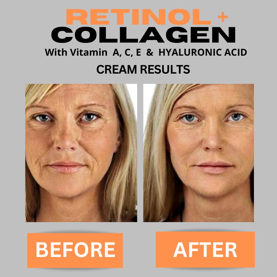 Retinol + Collagen Anti-Aging Face Cream with Hyaluronic Acid & Vitamin C - Day & Night Moisturizer for Wrinkles & Firming - 4oz - Perfect for Daily Skincare Routine & Anti-Wrinkle Treatment
