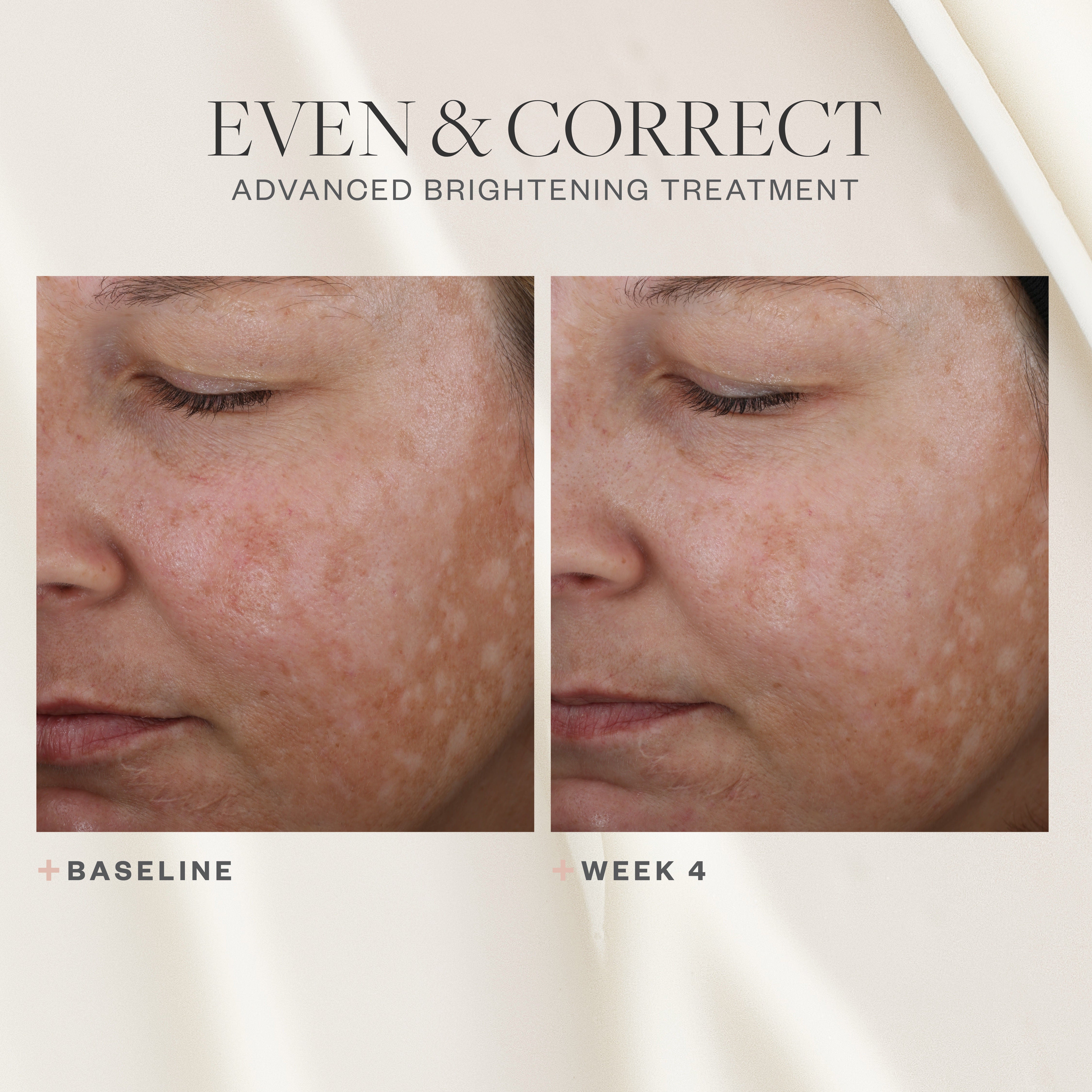 Even & Correct Advanced Brightening Treatment - Skin Brightening Serum for Dark Spots & Uneven Tone - Perfect for Daily Skincare Routine & Nighttime Use